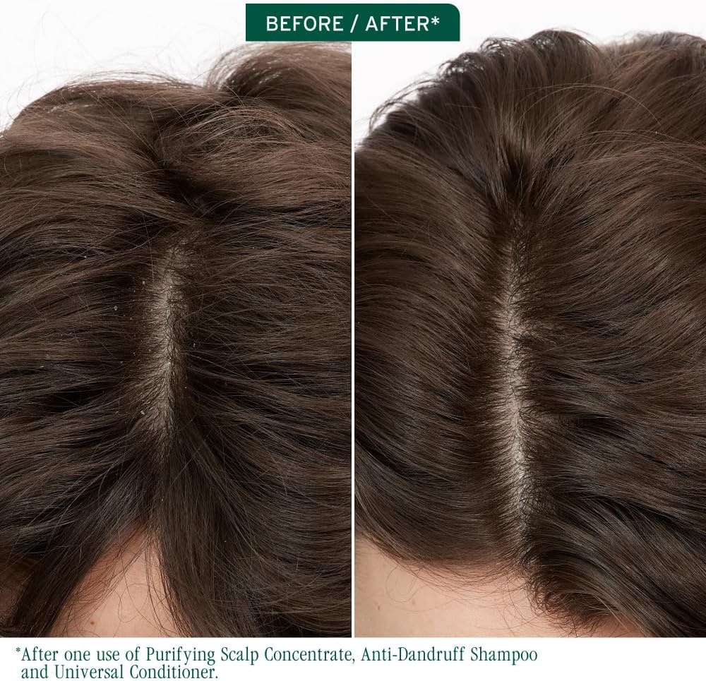 Detalle de Biolage Scalp Sync Purifying Scalp Concentrate (Glycolic Acid), 200ml