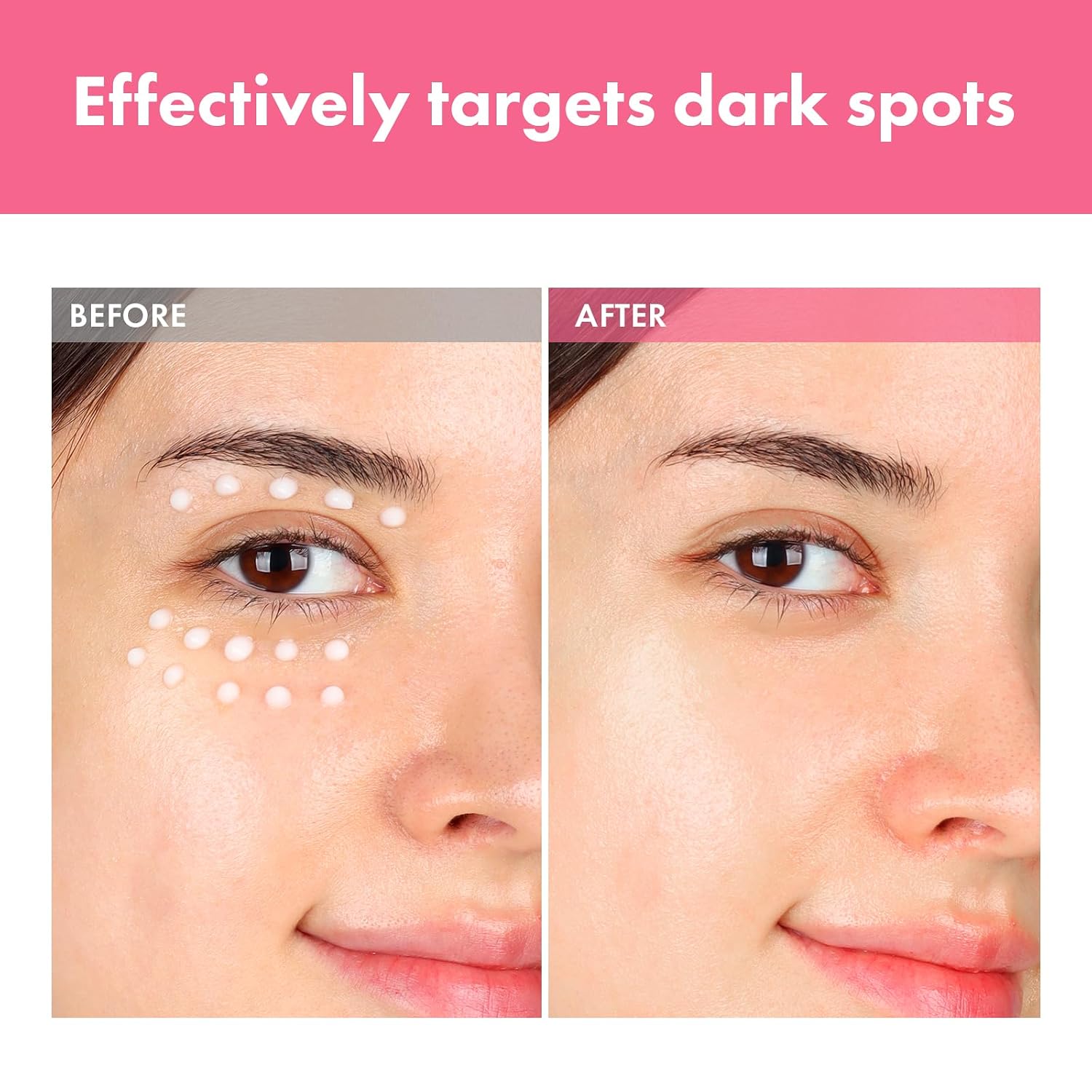 Thumbnail 2 de TOSOWOONG Arbutin 7% Intensive Spot Cream (70,000ppm), 20ml for Dark Spots & Freckles