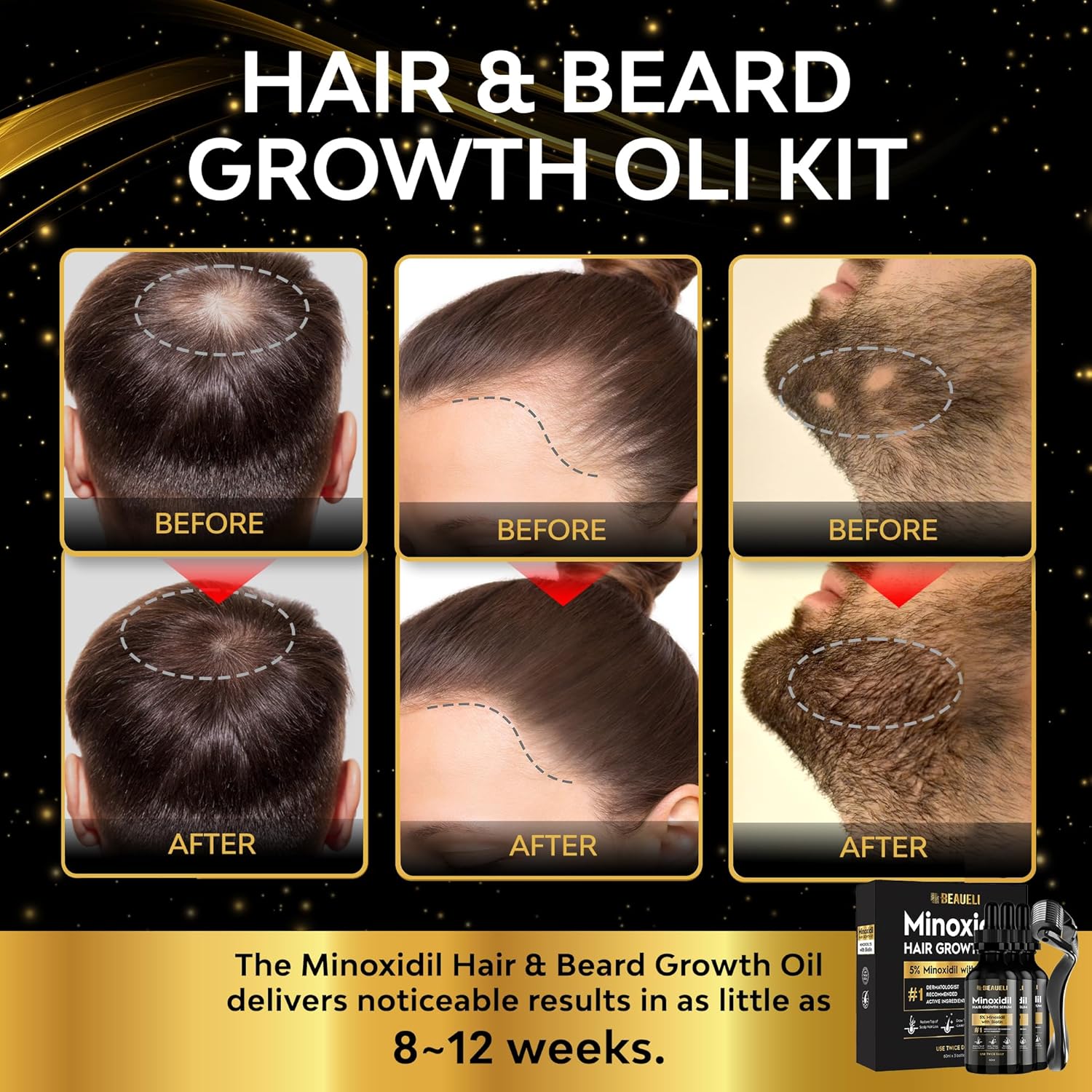 Detalle de Beaueli Minoxidil Beard Growth Kit for Men and Women (3 x 60 mL)