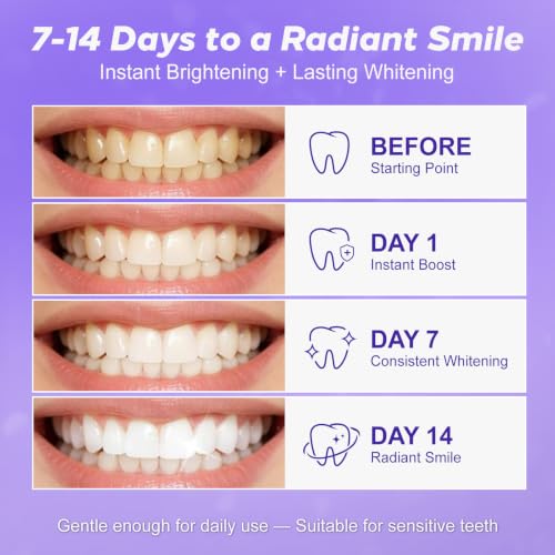 Thumbnail 6 de Purple Teeth Whitening Strips 14 Treatments by Pdoo – Enamel-Safe, No-Slip, No-Sensitivity Whitening Kit