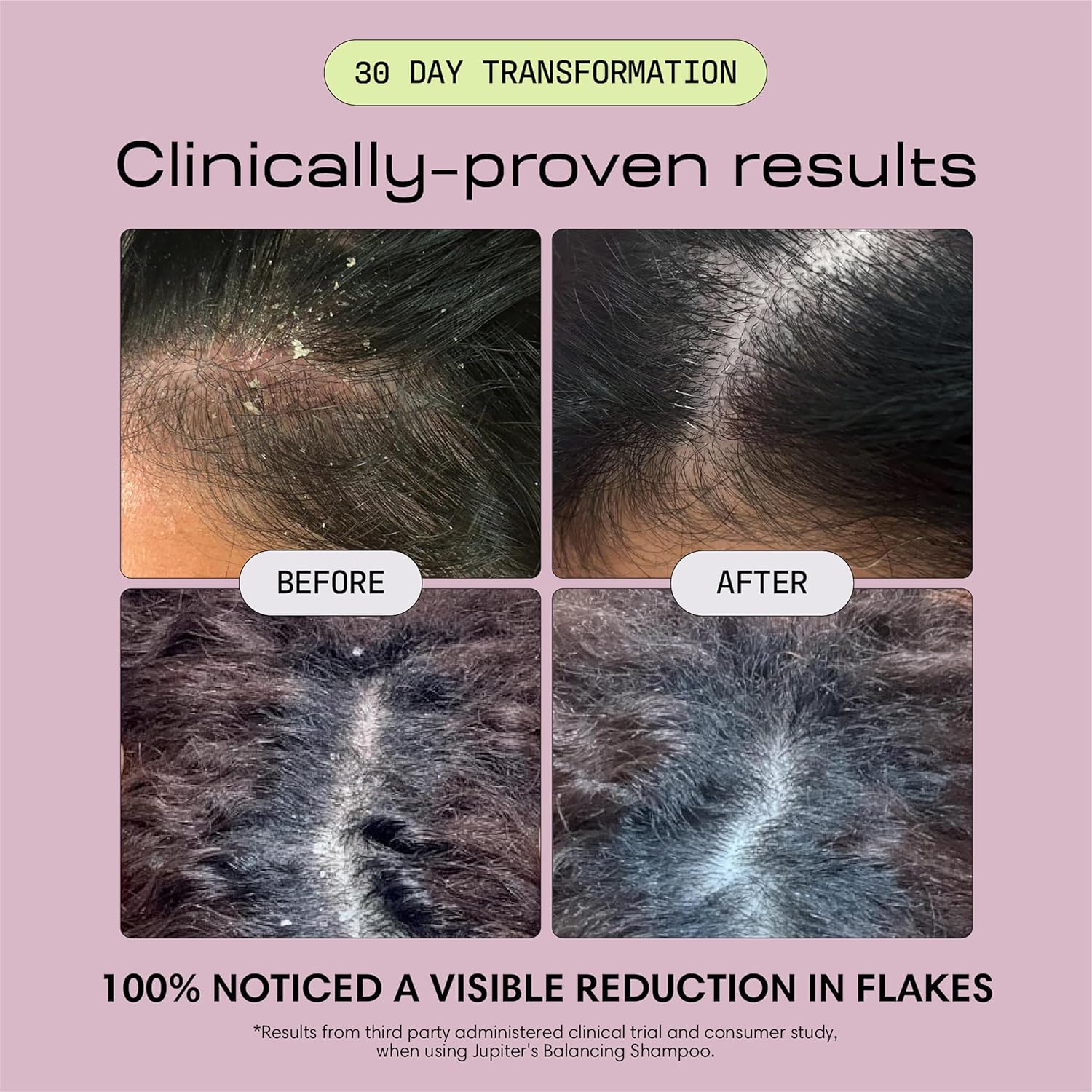 Thumbnail 3 de Jupiter Anti Dandruff 1% Zinc Pyrithione