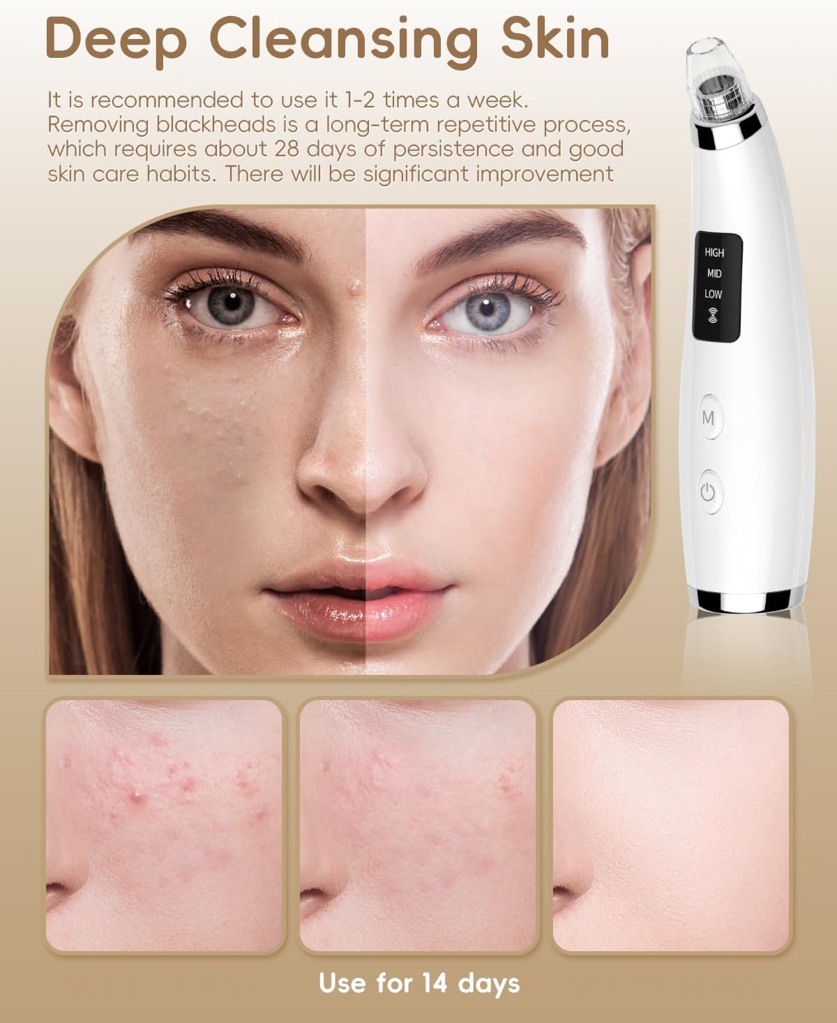 Detalle de Pore Vacuum Blackhead Remover - Pore Extractor with 5 Attachments & 3 Suction Levels (White)