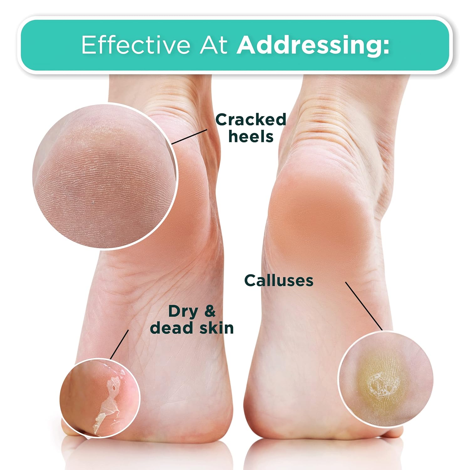 Thumbnail 4 de DERMORA Foot Peel Mask for Soft Feet