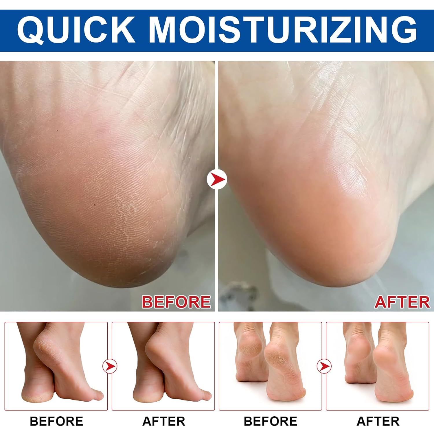 Detalle de Urea Fußcreme 60% Urea Fußbalsam Stick für trockene Fersen