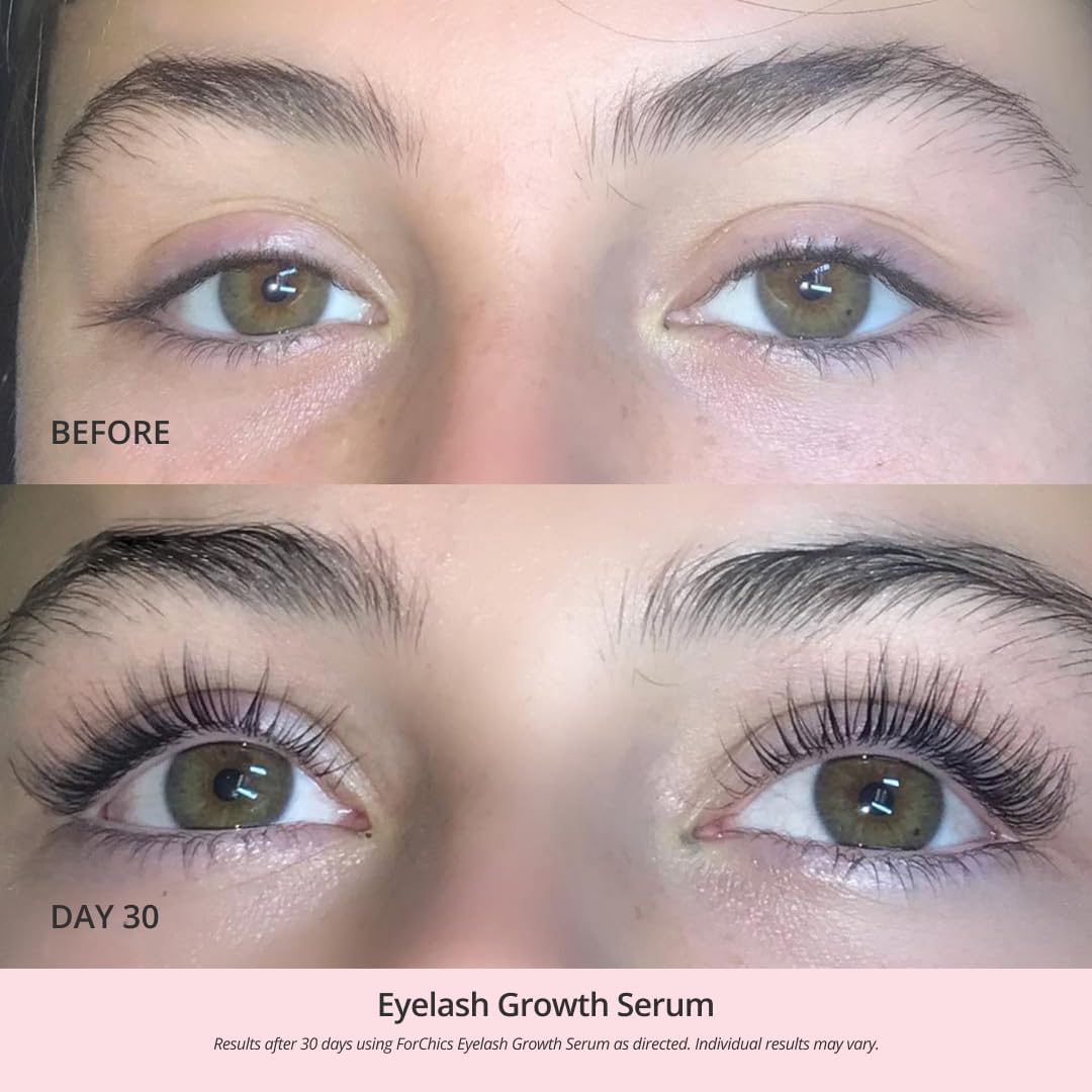 Thumbnail 3 de ForChics Lash Growth Serum 2 Weeks