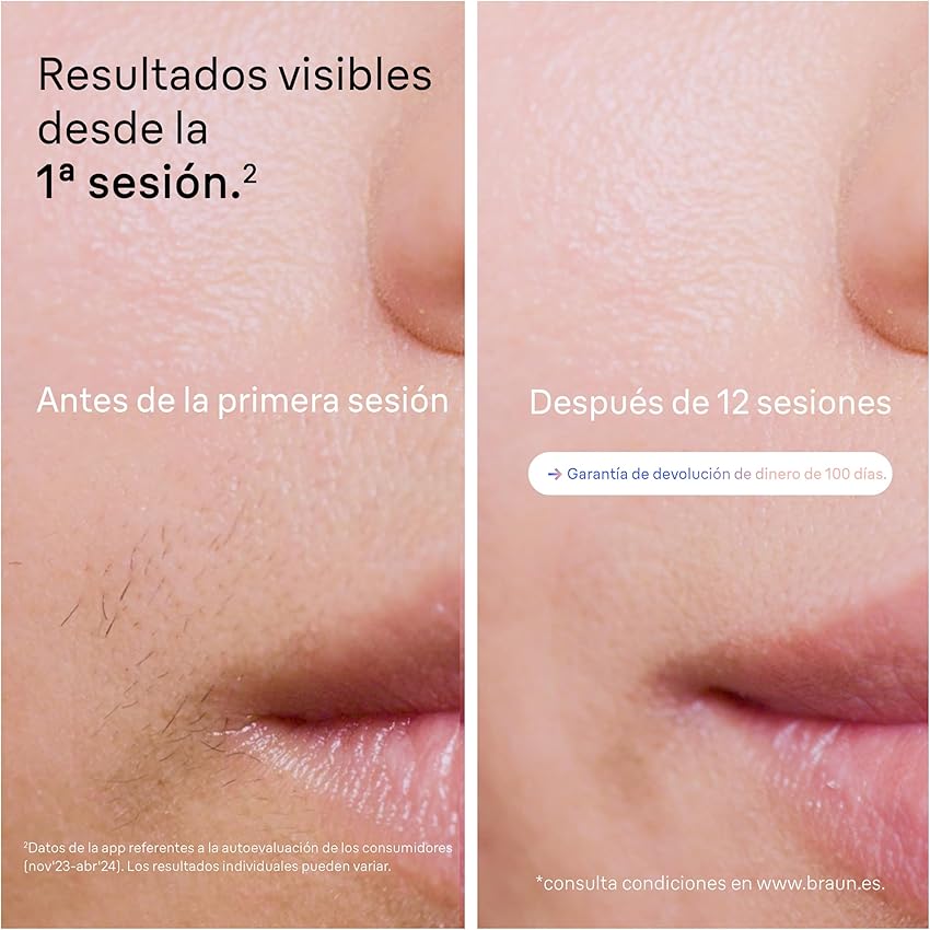 Thumbnail 4 de Braun Skin i·expert Smart IPL, Depilación Eficaz en Casa ✨