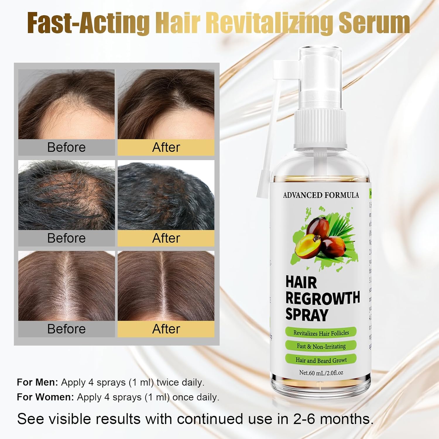 Detalle de Ballphl Siero Crescita Capelli Anticaduta 60 ml – Lozione spray a base di rosmarino, biotina, olio di ricino e batana