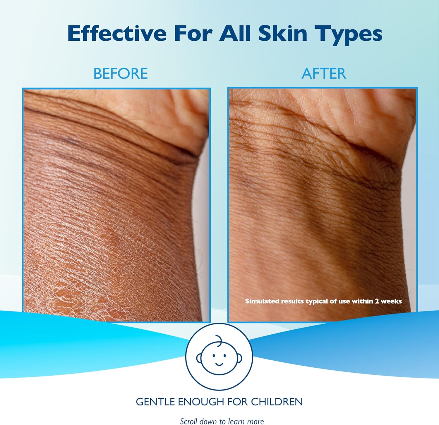 Detalle 2 de Glaxal Base av2022-Glaxal Base-itchy dry skin hypoallergenic parabenfree-ced51bac Moisturizing Cream, 450 g