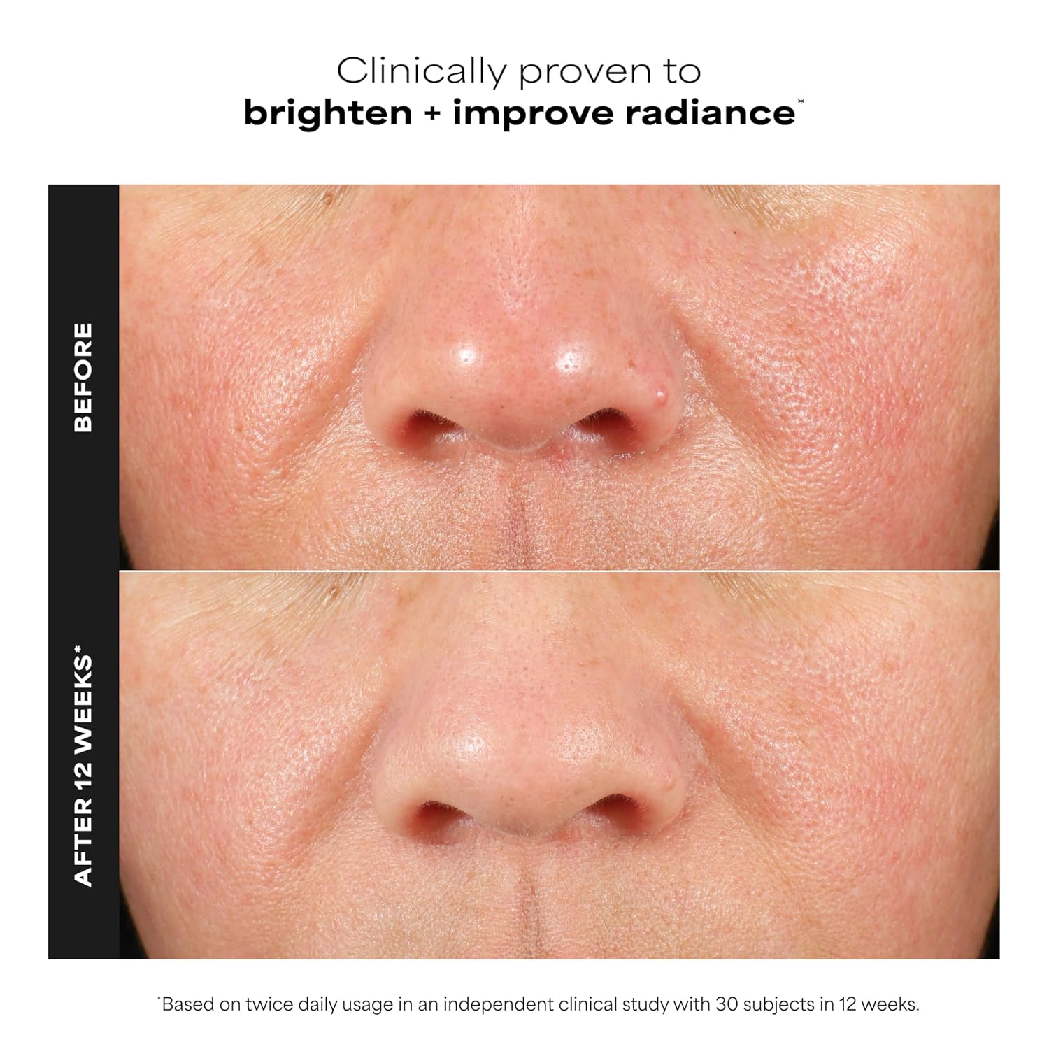 Thumbnail 1 de Paula's Choice BOOST C15 Super Booster 15% Vitamin C Serum (Fragrance-Free)