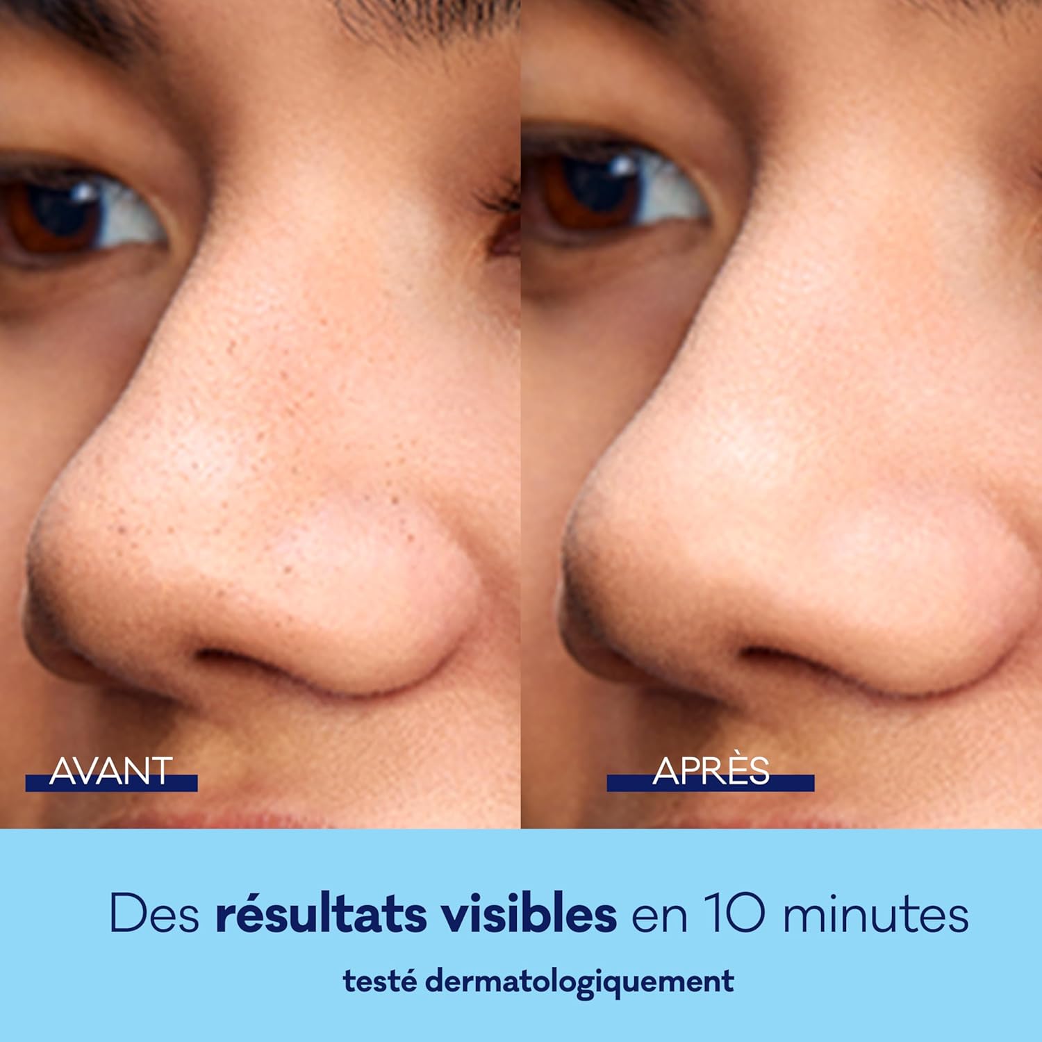 Thumbnail 4 de Biore 8 Patchs Purifiants au Charbon MAXI – Élimine les impuretés en 10 minutes