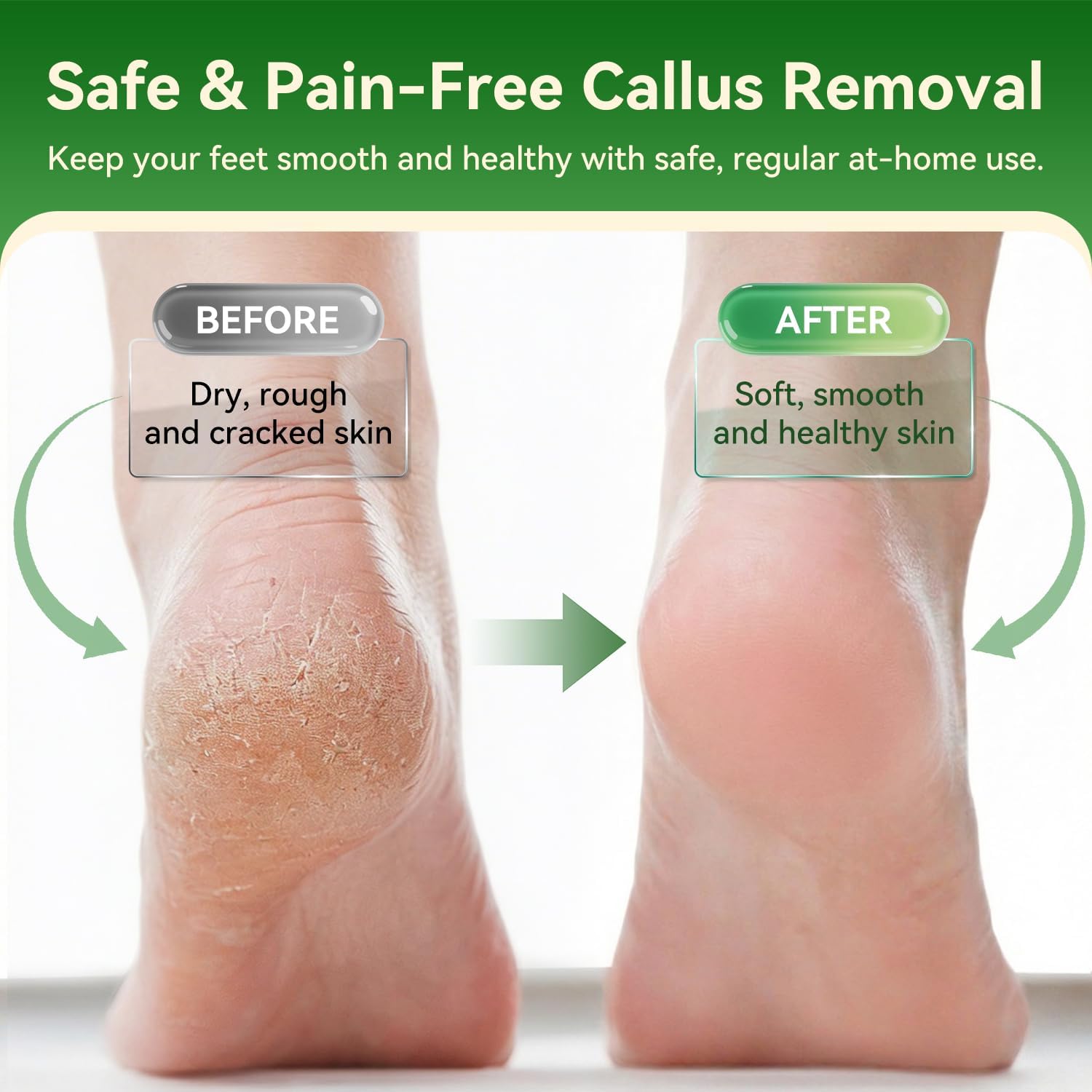 Detalle 2 de Electric Foot File USB rechargeable callus remover