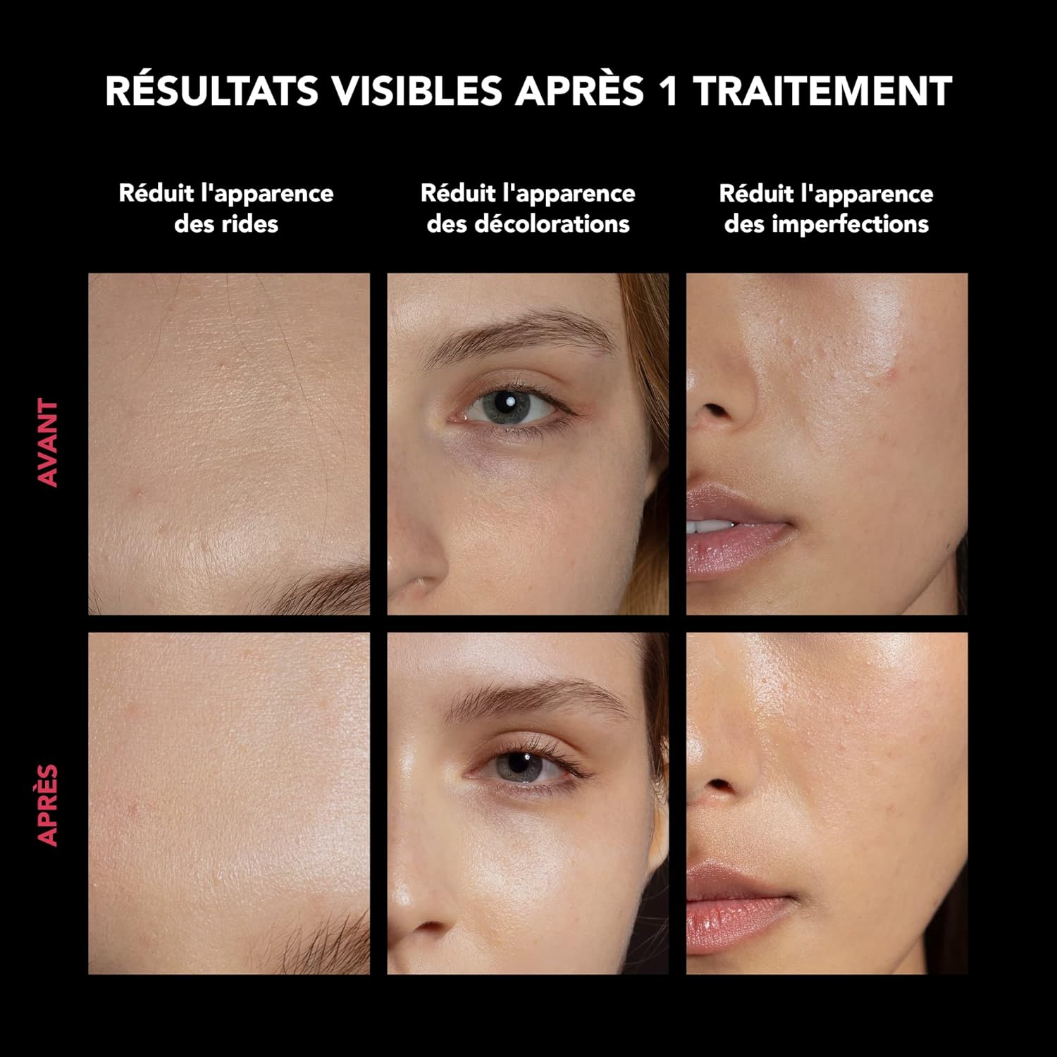 Thumbnail 3 de FAQ 202 Masque LED visage sans fil en silicone avec 8 réglages lumineux et étui de voyage