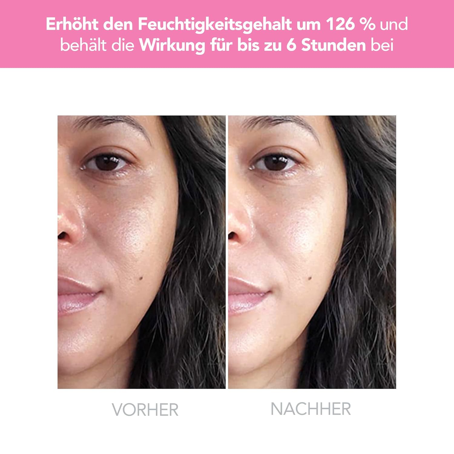 Thumbnail 4 de Foreo Ufo 2 LED-Gesichtsmaske – Vollspektrum LED, Wärme/Kühlung & T-Sonic Massage