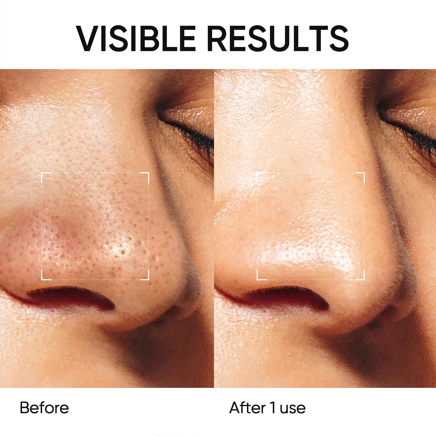 Thumbnail 3 de SKINTIFIC Deep Pore Cleansing Blackhead Remover Face Mask Stick with Volcanic Clay