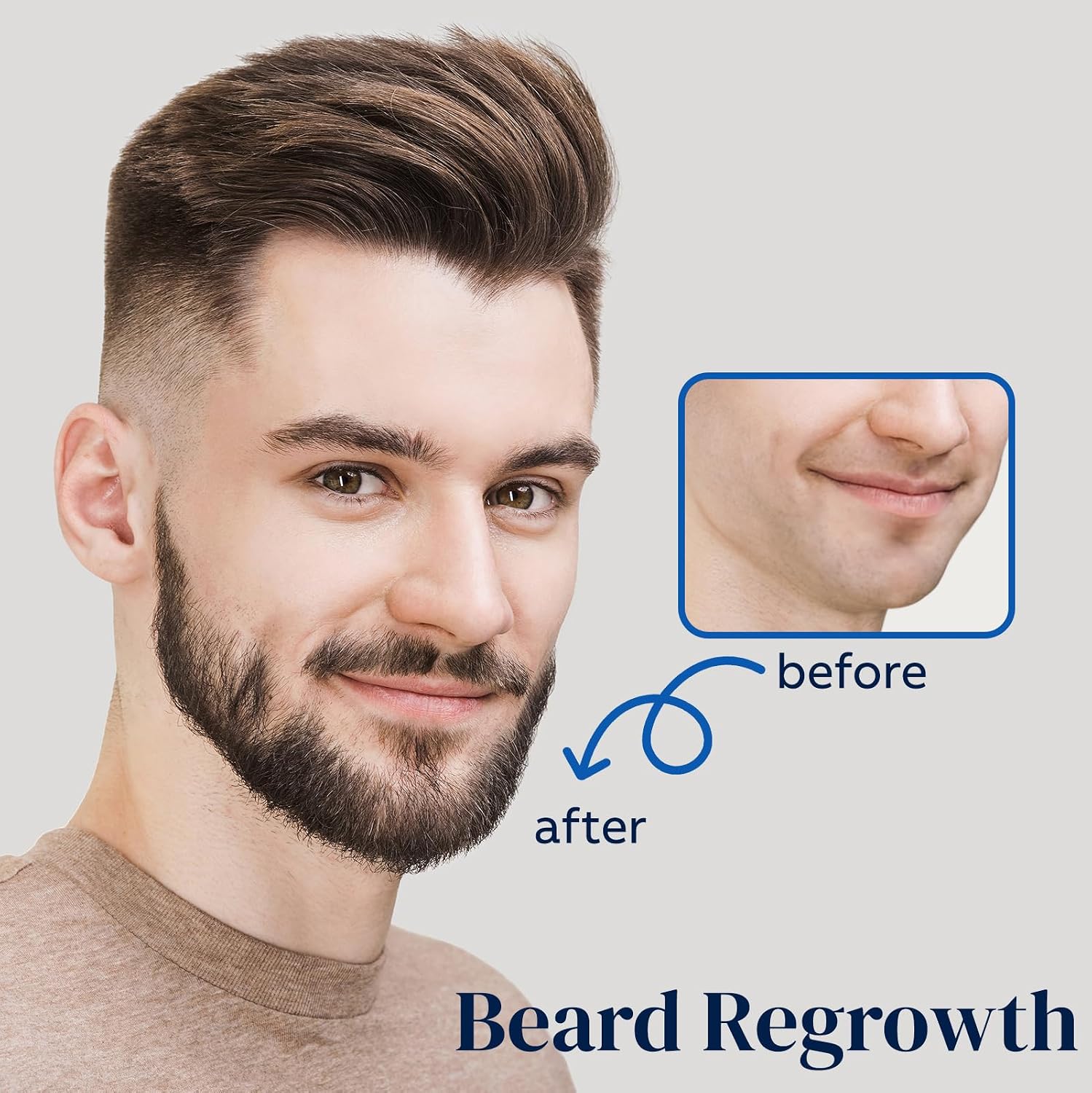 Detalle de 5% Minoxidil for Men Beard and Hair with Biotin & Castor Oil — Dual Spray (60ml, 2PCS)