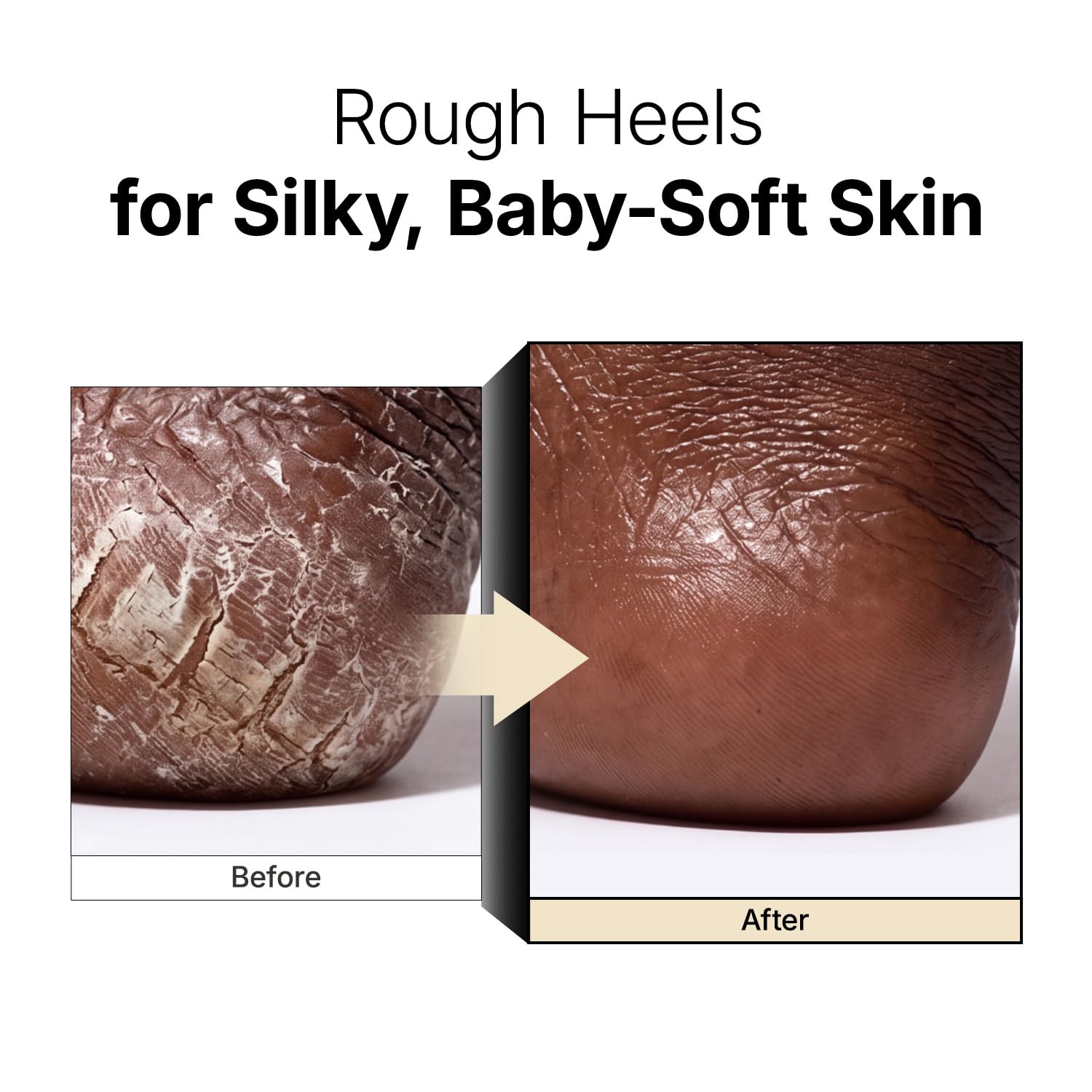 Thumbnail 6 de MANYO Galactomy Enzyme Peeling Gel 2.5 fl oz