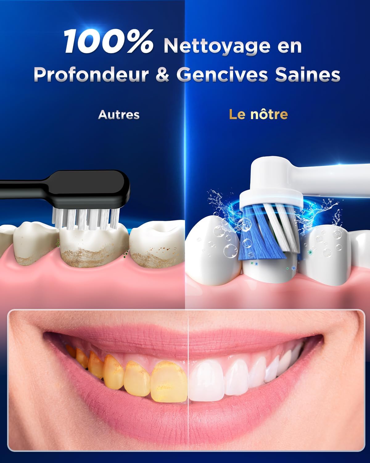 Detalle de YTEATH PRO Brosse À Dent Électrique Rotatives — Gencives Sensibles, 8 Têtes, 5 Modes et 3 Intensités