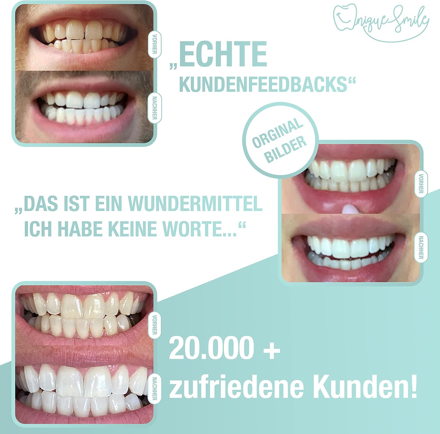 Thumbnail 1 de UniqueSmile Teeth Whitening Kit „All in One Bundle“ – Nachfüll-Set mit 3 Gel-Stiften (für bis zu 15 Anwendungen)