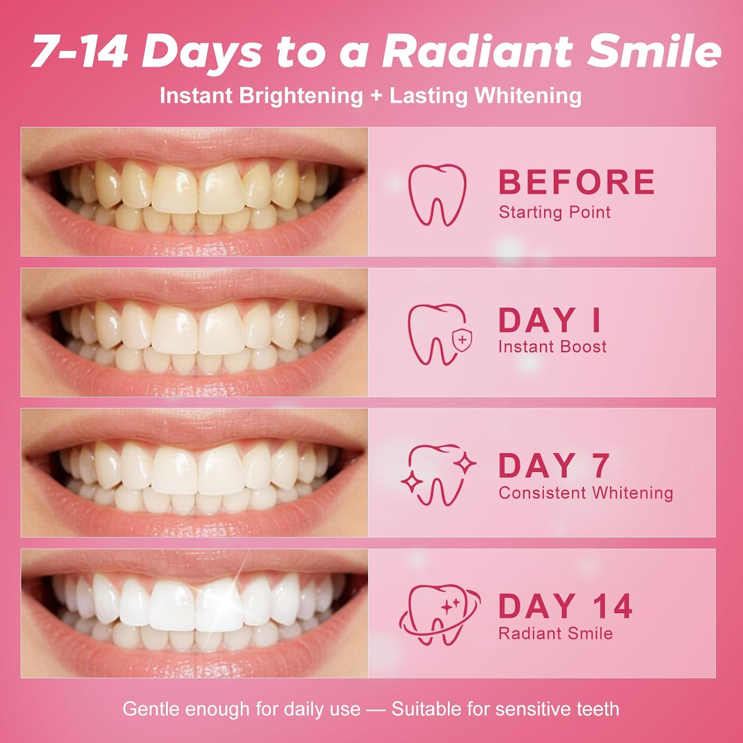 Detalle 2 de Pdoo LED Teeth Whitening Kit with Rechargeable Tray and 5 Gel Pens
