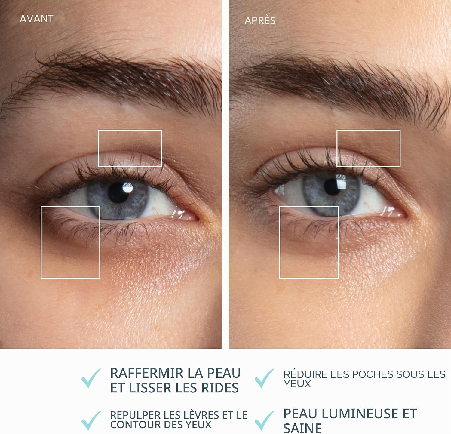 Thumbnail 4 de FOREO BEAR 2 eyes & lips – Appareil anti-rides à micro-courant pour yeux et lèvres