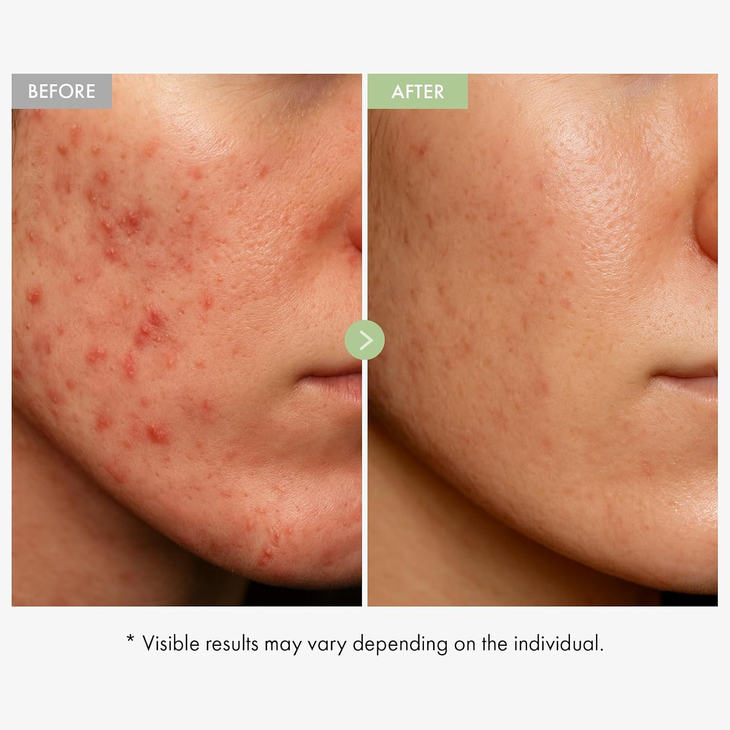 Detalle de TOSOWOONG Crema Viso Exosome CICA – Idratazione lenitiva per pelli sensibili, 50 ml