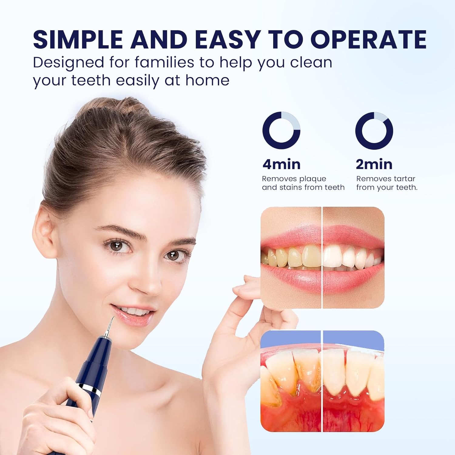 Thumbnail 2 de HOKIN Plaque Remover Dental Care Kit (5-piece stainless steel tools) – teeth cleaning, filling repair set & plaque detection
