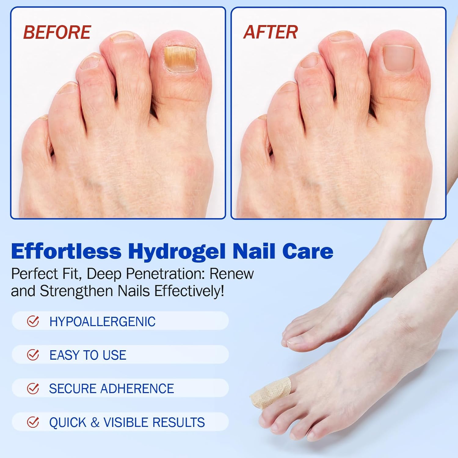 Detalle de Nail Patches for Toenail Repair (42PCS) — Overnight 8-Hour Support for Damaged, Thick, or Yellow Toenails