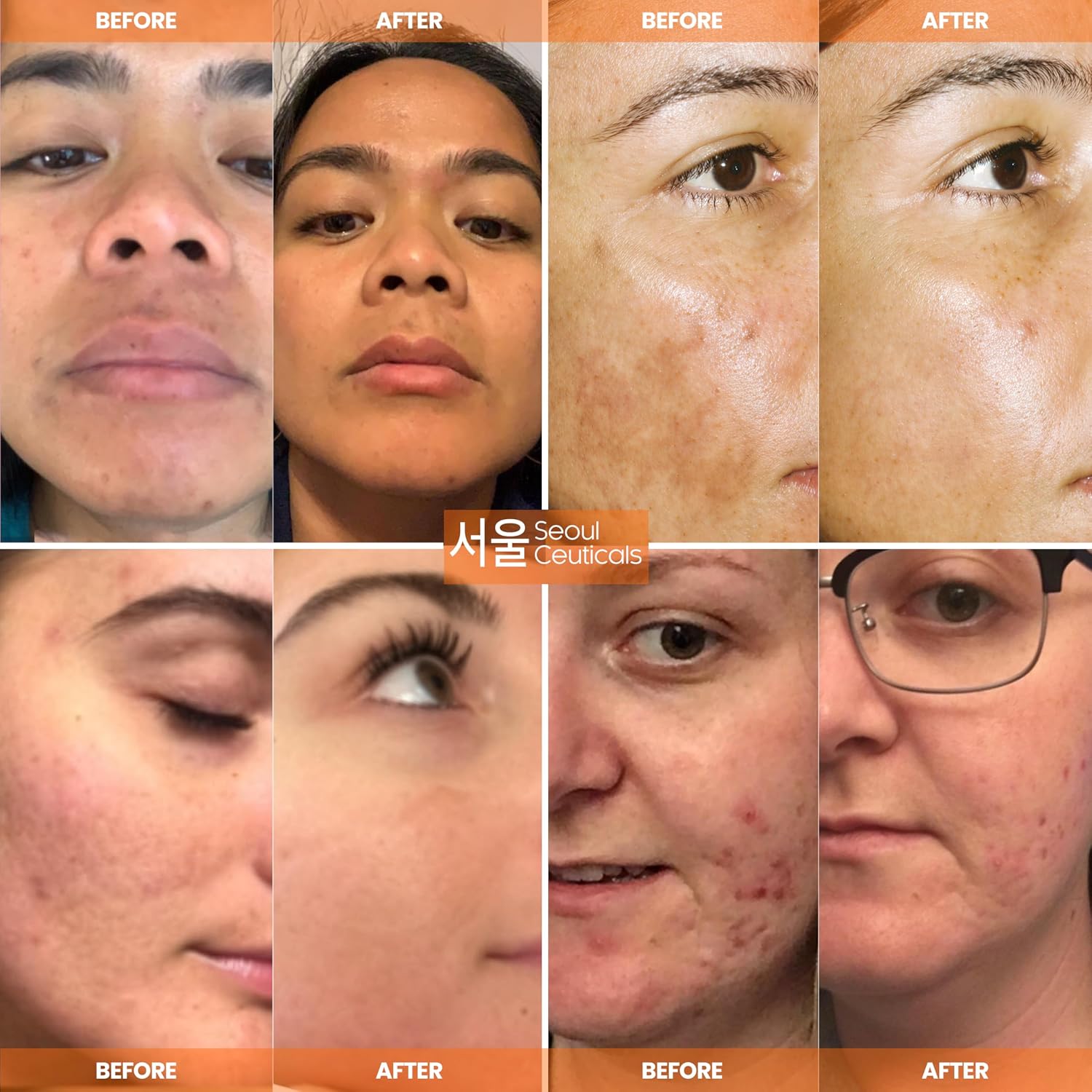 Detalle de SeoulCeuticals 20% Vitamin C Serum ⚙