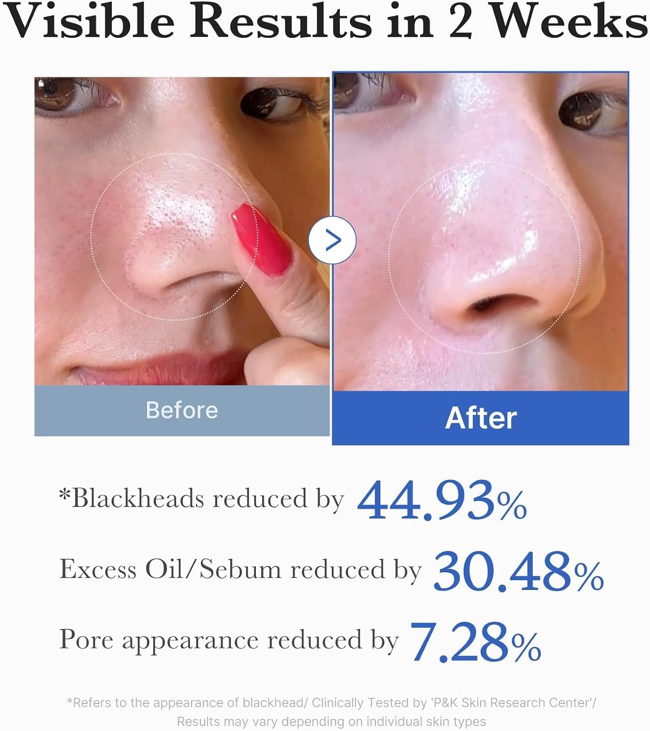 Thumbnail 4 de medicube Toner Pads Zero Pore Pad 2.0 for Exfoliation and Pore Care
