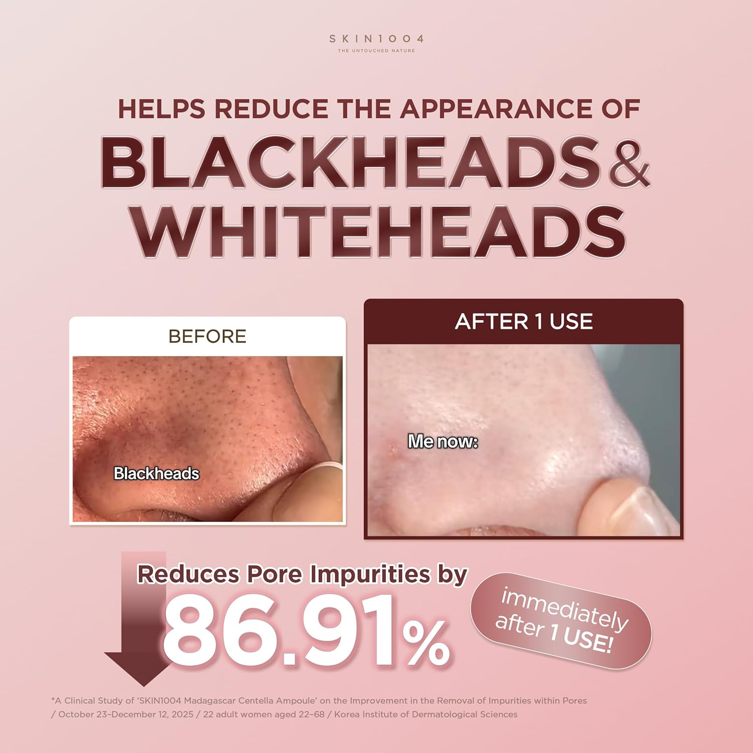 Detalle 2 de SKIN1004 Poremizing Quick Clay Stick Mask 27g