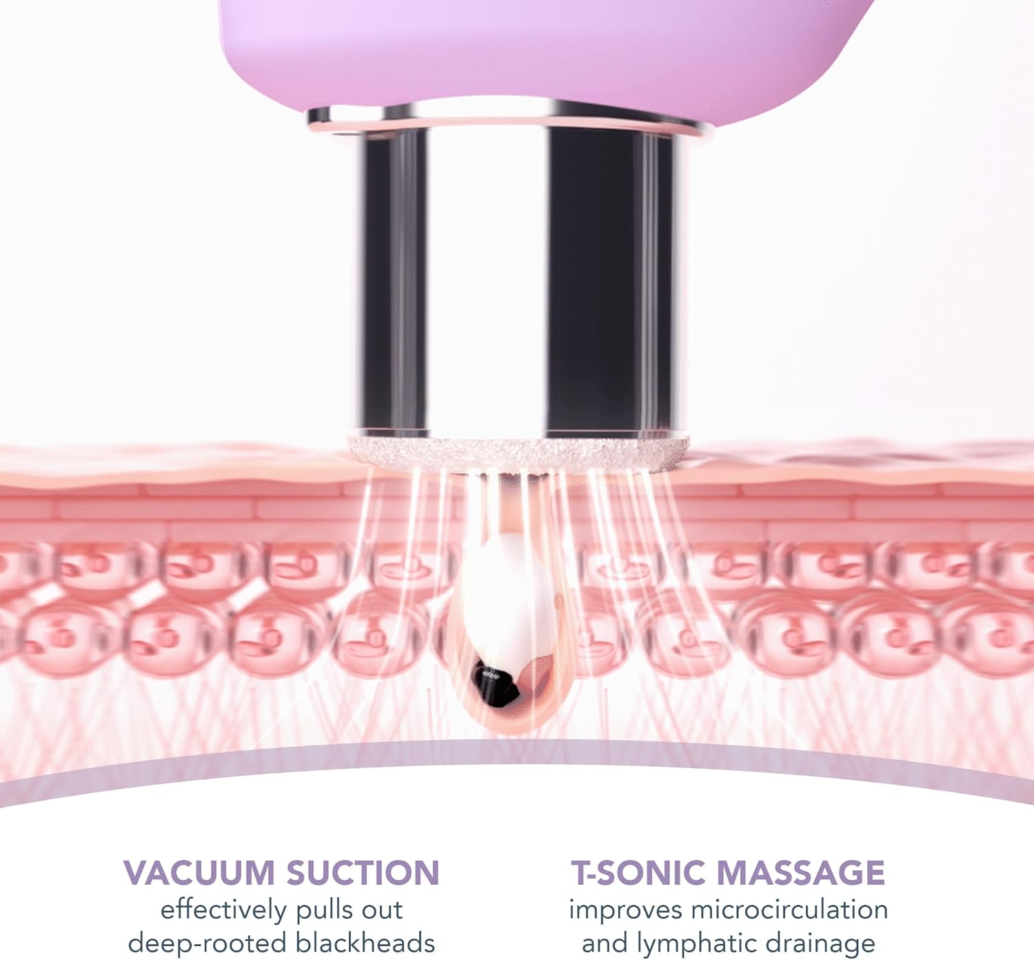 Thumbnail 5 de FOREO KIWI derma: dispositivo di microdermoabrasione, aspirazione punti neri e maschera kiwi