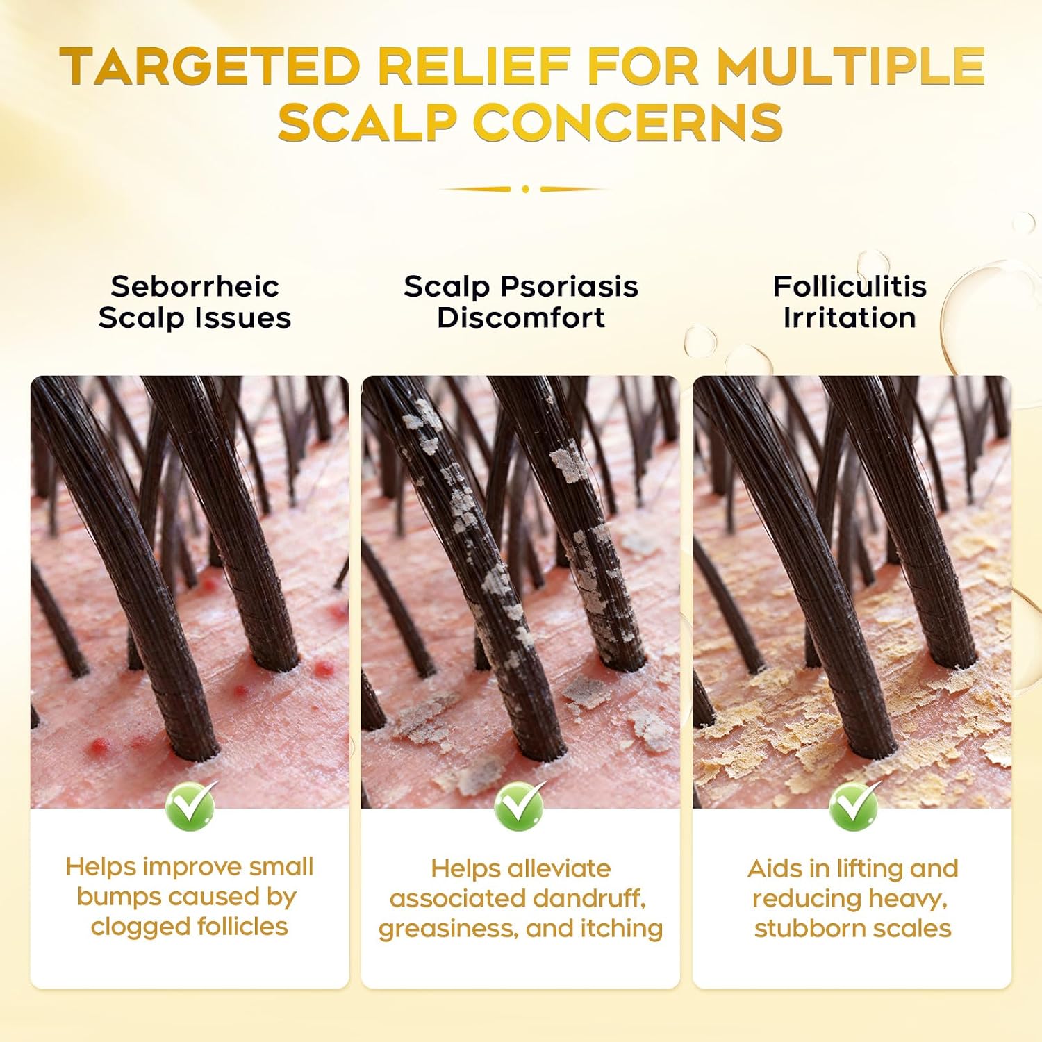 Detalle de Antifungal Shampoo, 10.1 fl oz