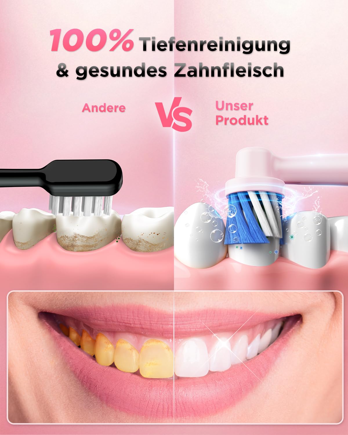 Thumbnail 1 de Rotierende elektrische Zahnbürste für Erwachsene & Kinder mit 8 Aufsteckbürsten, 3 Intensitäten, 5 Modi und Wand-Ladestation (Perlmuttrosa)