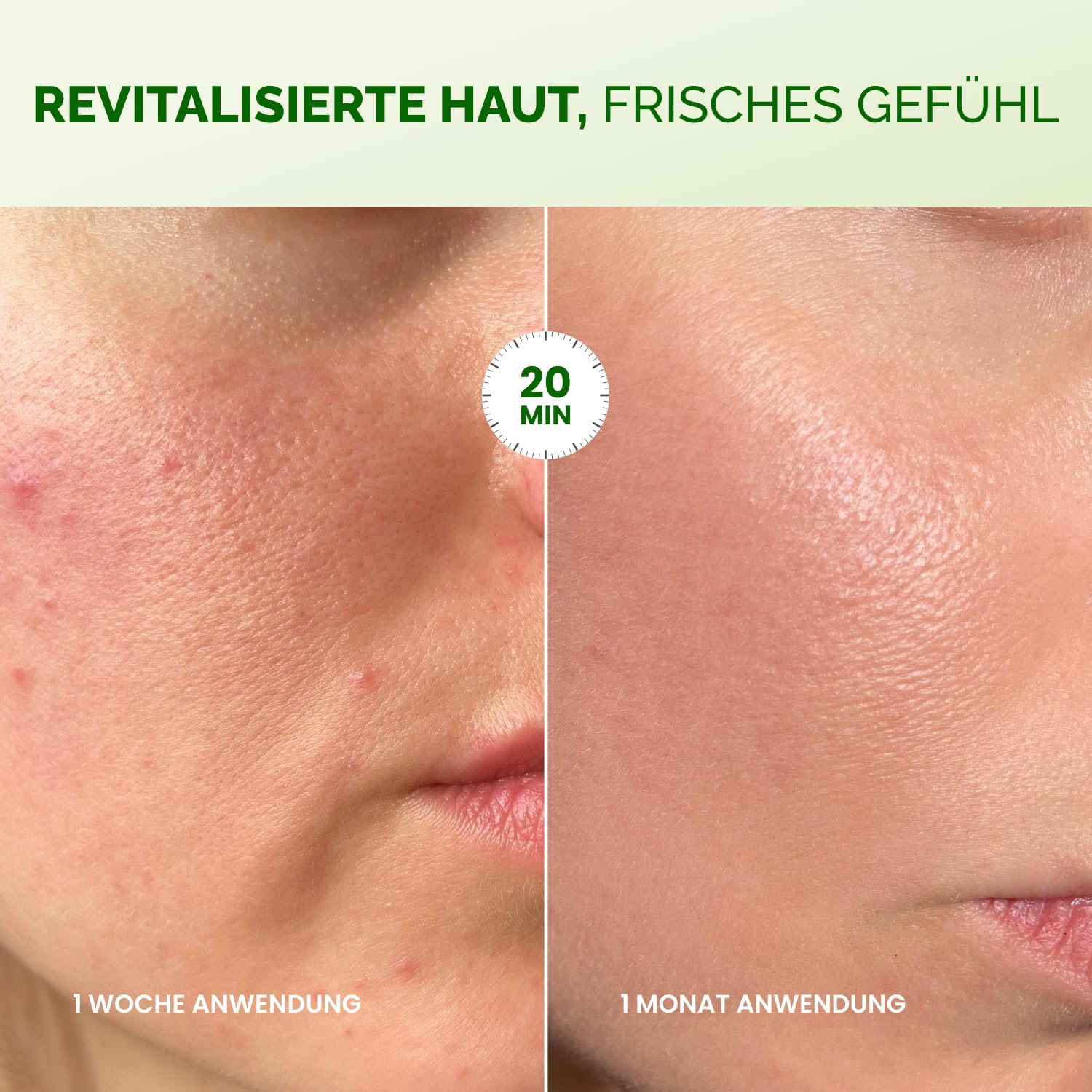 Thumbnail 4 de PLANTIFIQUE Koreanische Gesichtsmaske 5-Pack mit Centella, Niacinamid & Hyaluronsäure – Tuchmasken für Feuchtigkeit und Beruhigung
