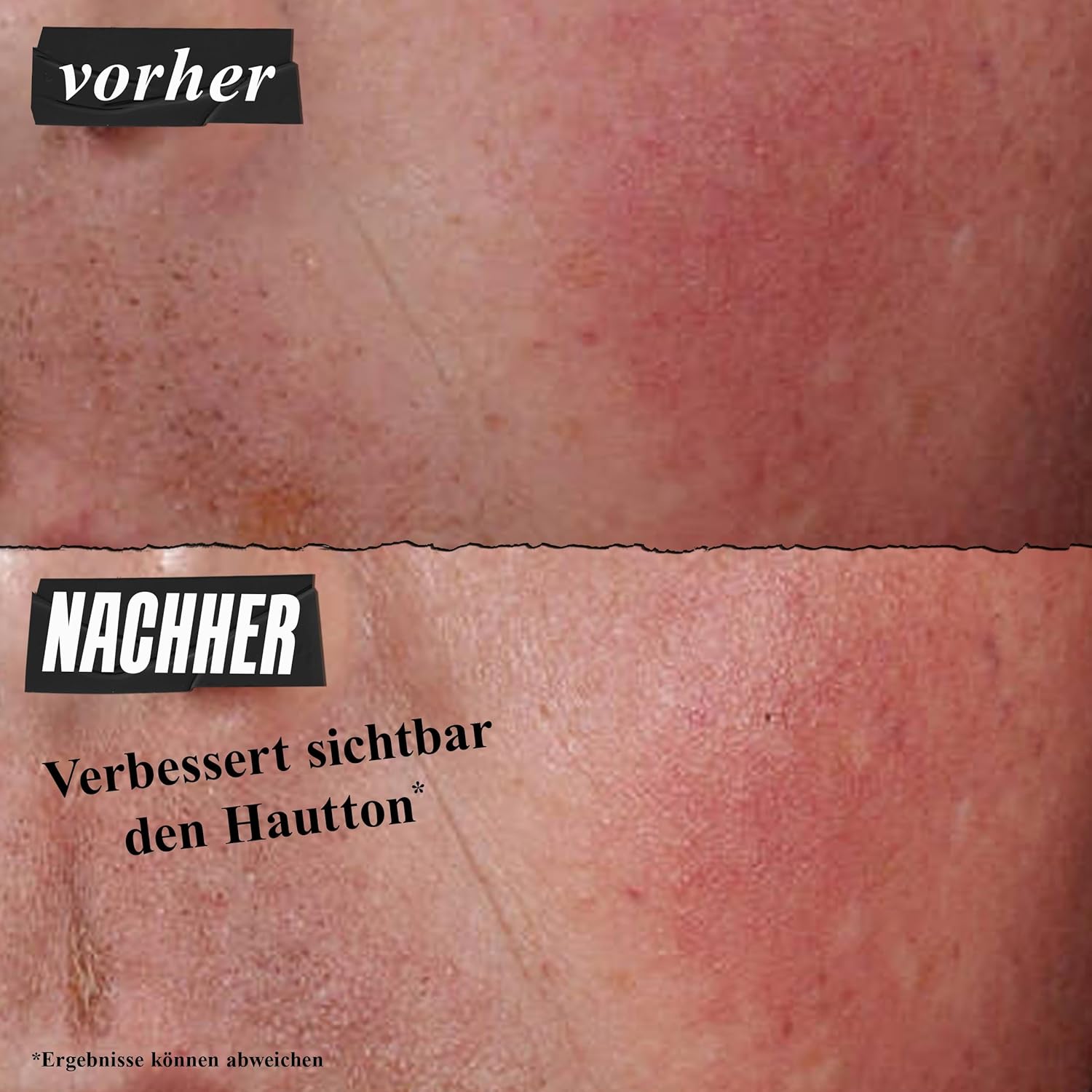 Thumbnail 3 de KIEHL’S Ultra Facial Advanced Repair Barrier Cream (50 ml) – intensiv pflegende Gesichtscreme für sehr trockene, empfindliche Haut