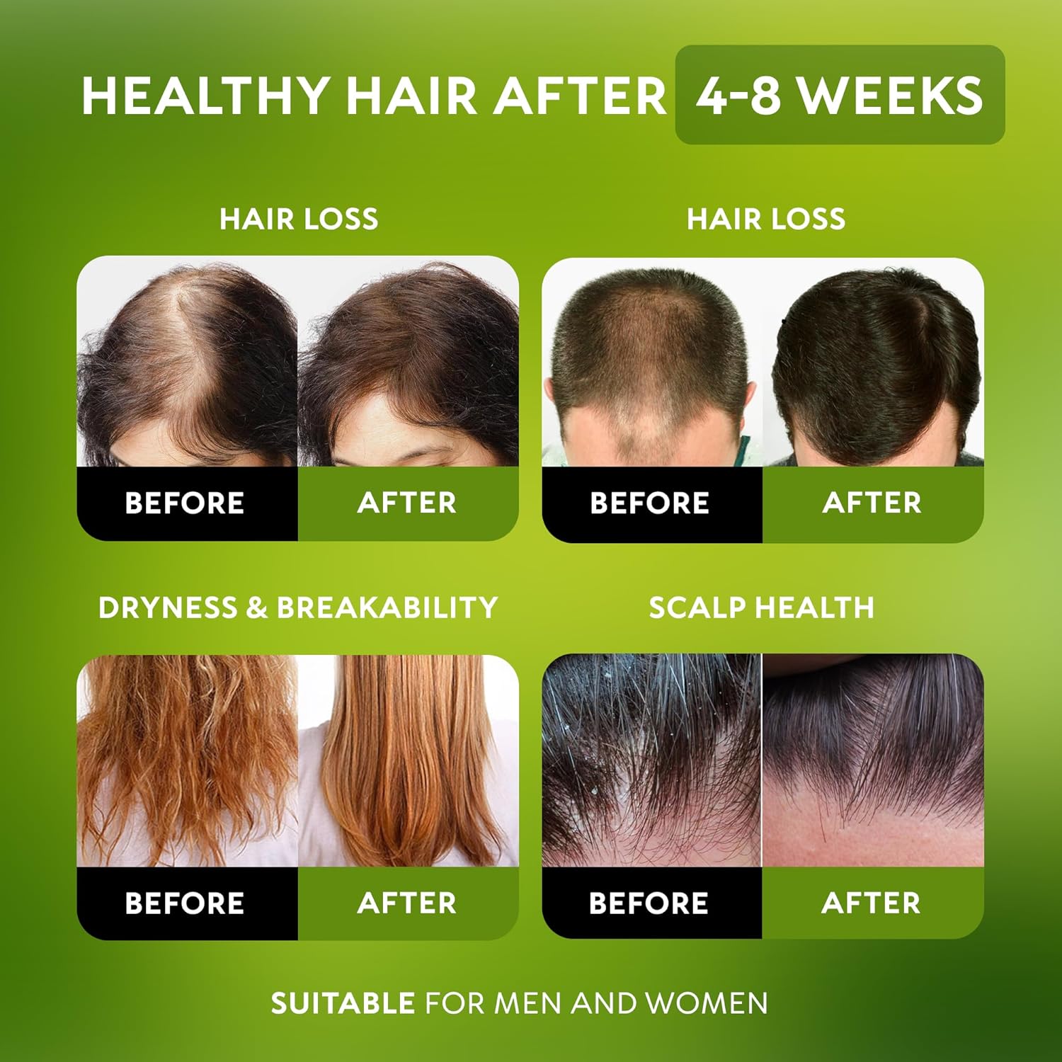 Detalle 2 de Batana Oil for Hair Growth 4.23 oz