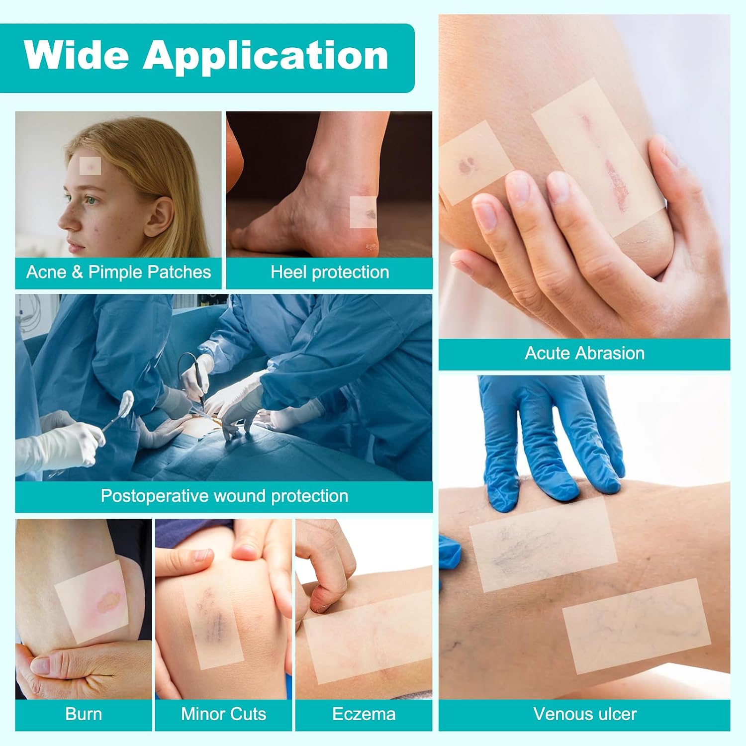 Detalle de TINBOTO TIN-WHC-FT Hydrocolloid Wound Care Roll, 2IN x 4.8FT