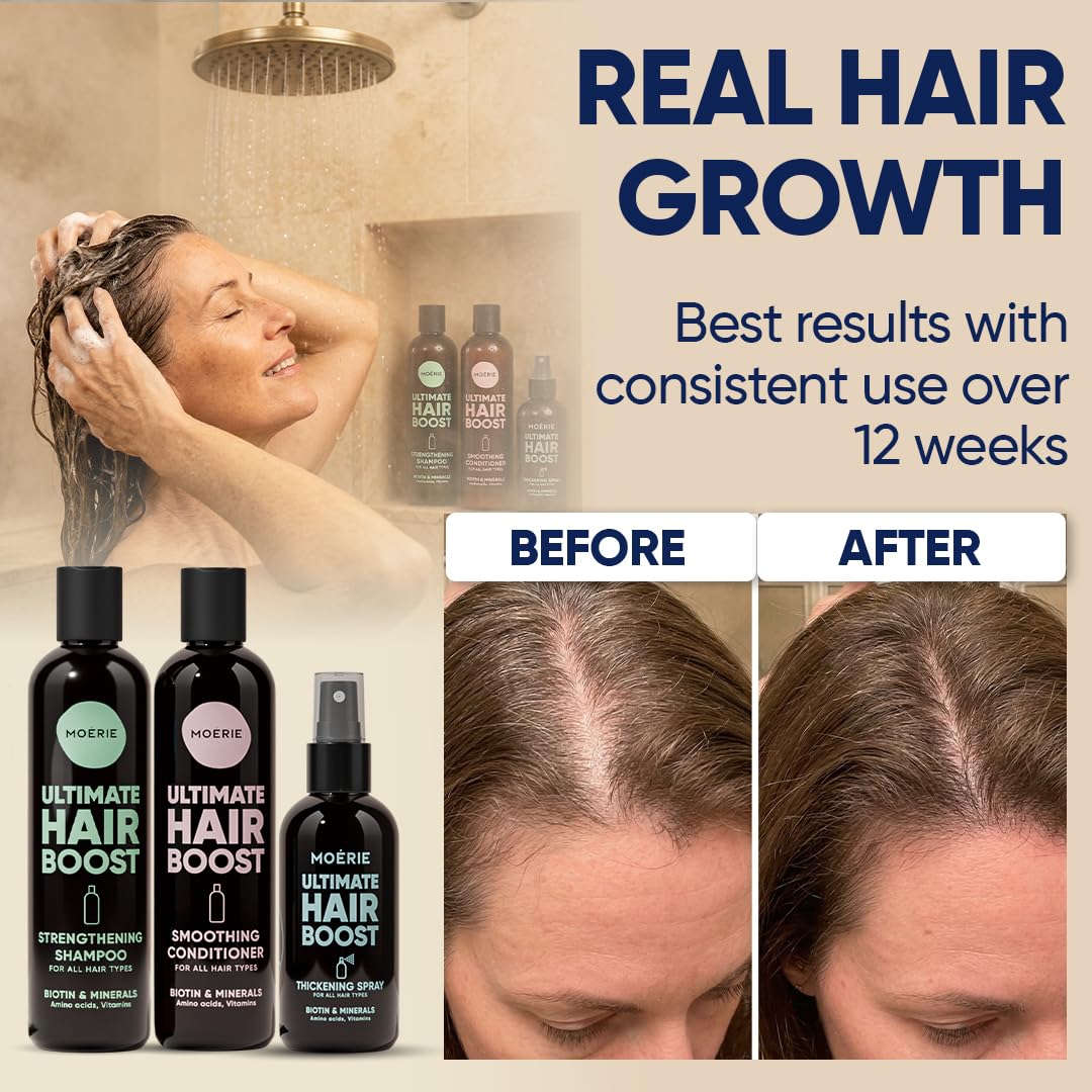 Thumbnail 2 de MOERIE Shampoo Set – gegen Haarausfall, Conditioner, Haarwachstum Serum & Haarmaske (3er-Set) – vegan, 77 Mineralien
