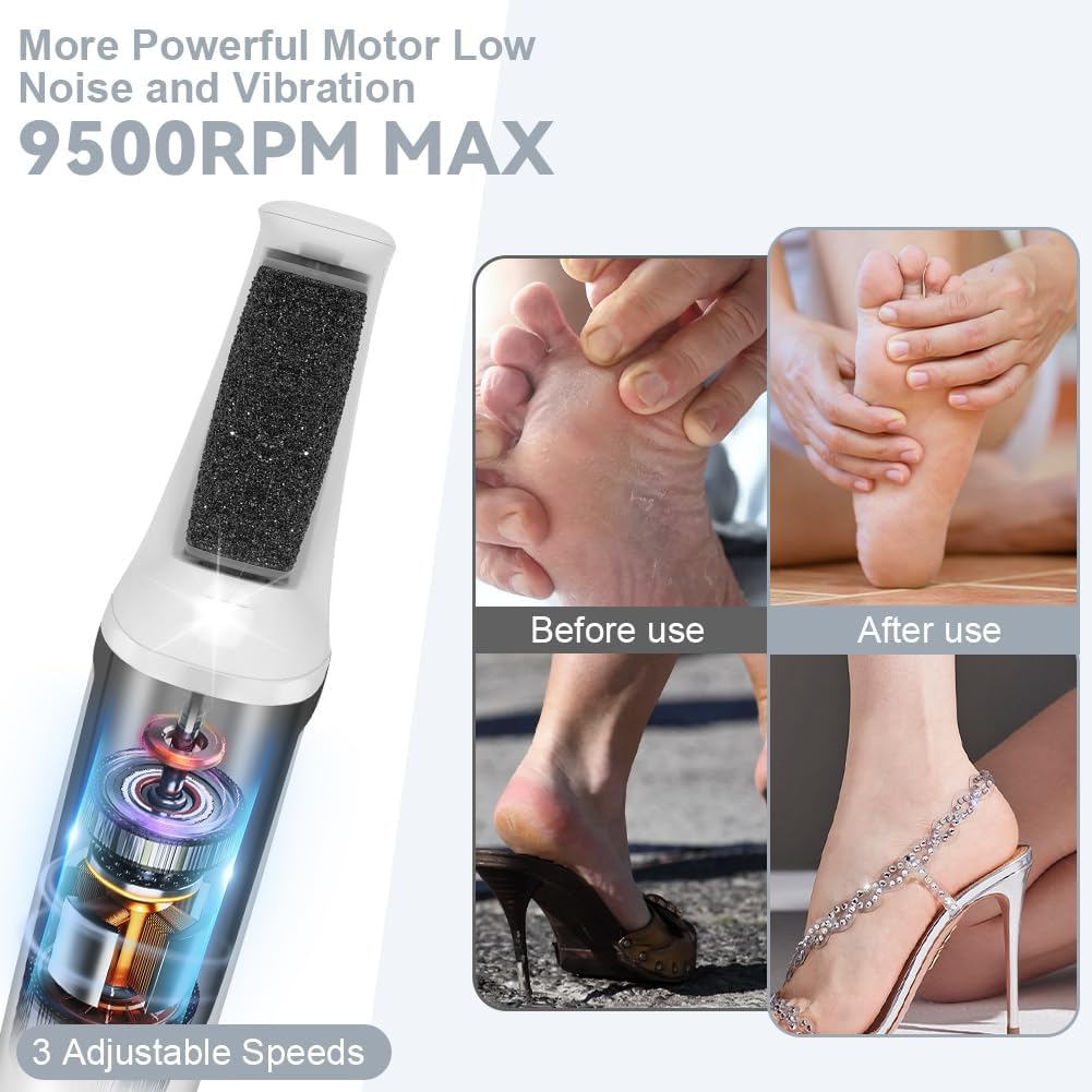 Thumbnail 4 de AOOWU Pedicure Elettrico Professionale 1200 mAh