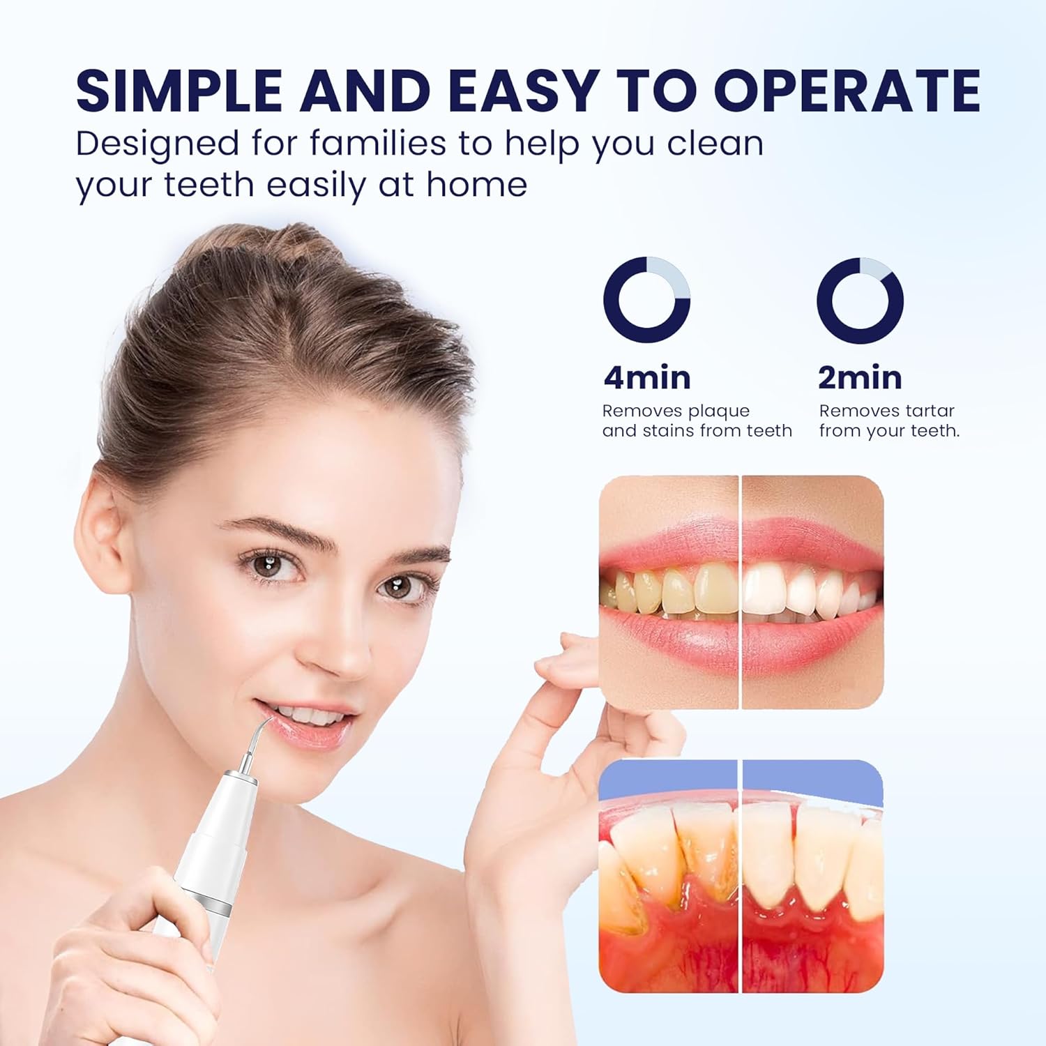 Detalle de HOKIN Plaque Remover Dental Care Kit: Stainless Steel Teeth Cleaning Tools for All the Family
