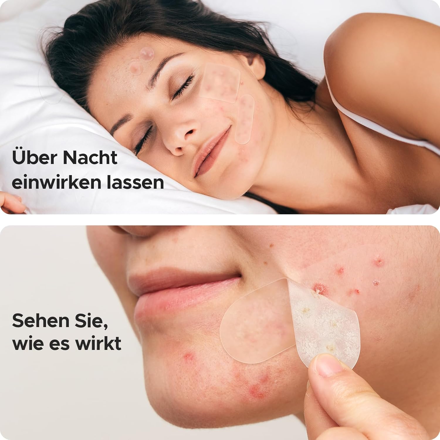Detalle de TKTK Pickel Patch für Gesicht – XL Hydrocolloid-Patches (270 Stück)