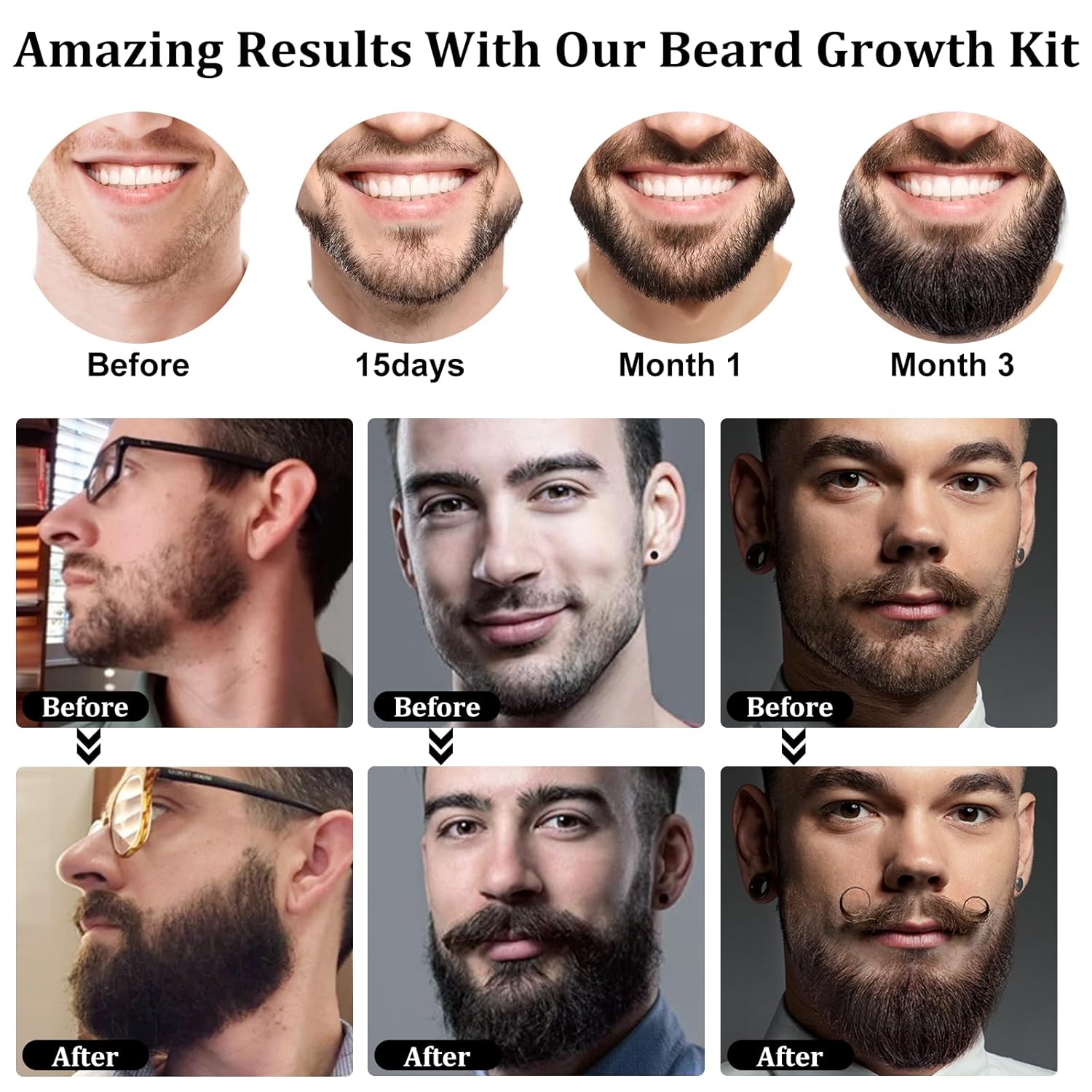 Detalle de RAFFIN Beard Growth Kit with 2oz Beard Growth Oil, 3X Biotin & Castor Oil + Premium Beard Massager