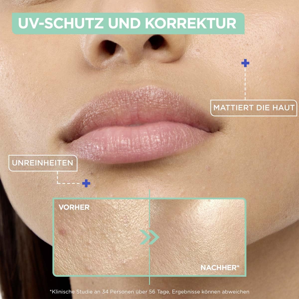 Thumbnail 5 de Mixa Tägliches UV-Fluid LSF50+ Anti-Unreinheiten (40 ml) – hoher UVA/UVB-Schutz