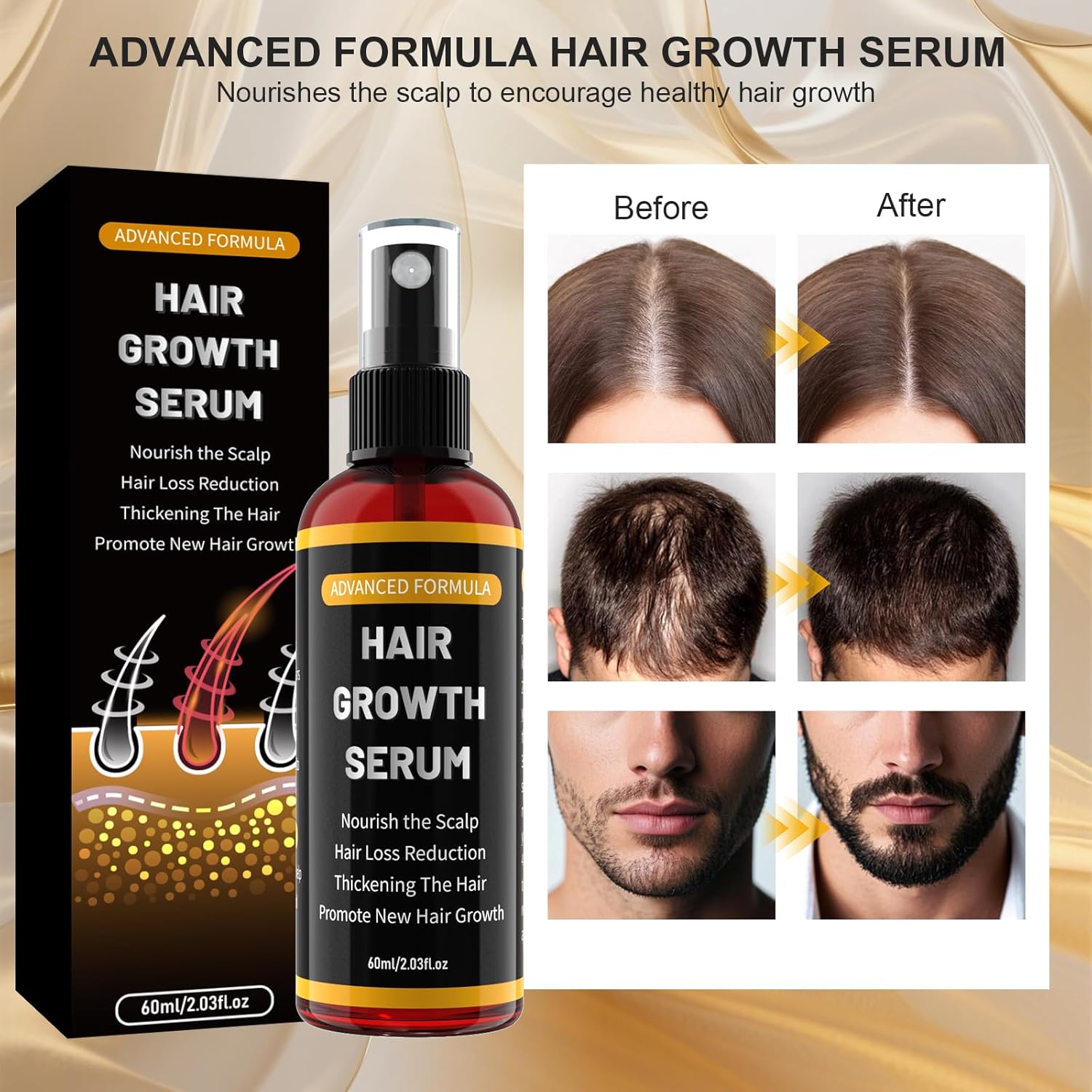Detalle de Rouclo Siero Crescita Capelli con Biotina, Olio di Ricino e Rosmarino – 60 ml