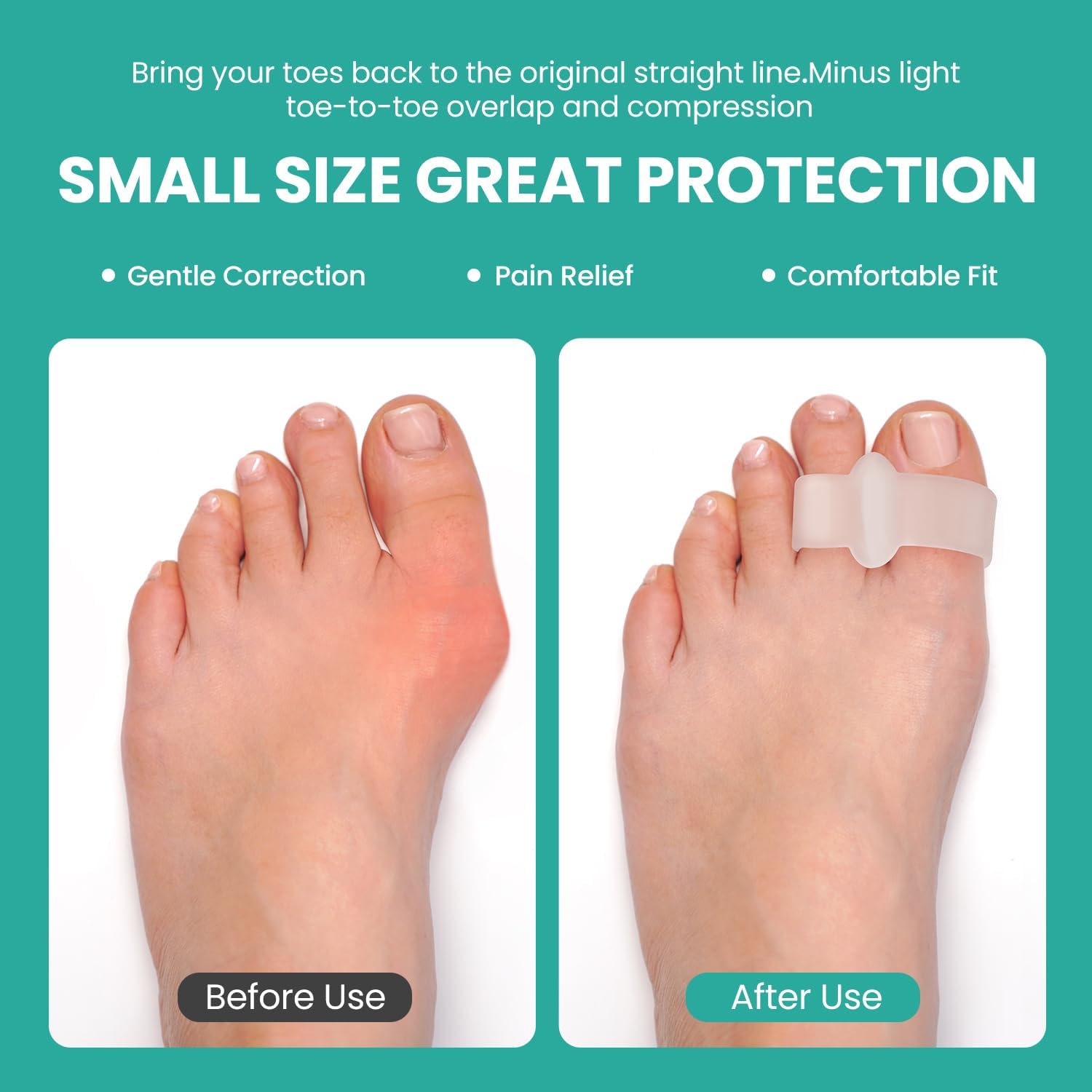 Detalle de Welnove 12er-Pack Gel-Bunion-Korrektor mit Aloe: Zehentrenner zur Schonung bei Ballenzehen & Hammerzehen