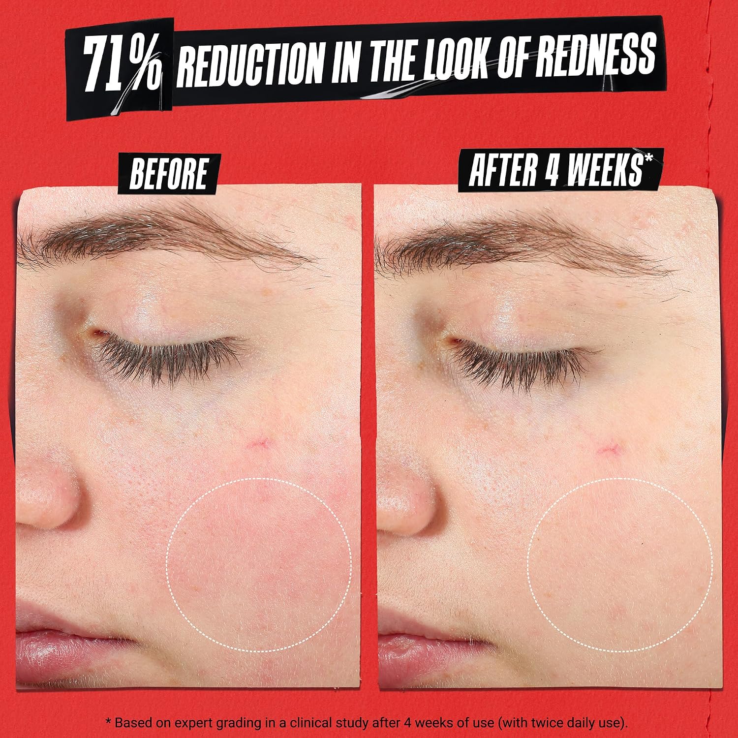 Detalle 2 de Kiehl's Ultra Facial Meltdown Recovery Barrier Cream, 1% Colloidal