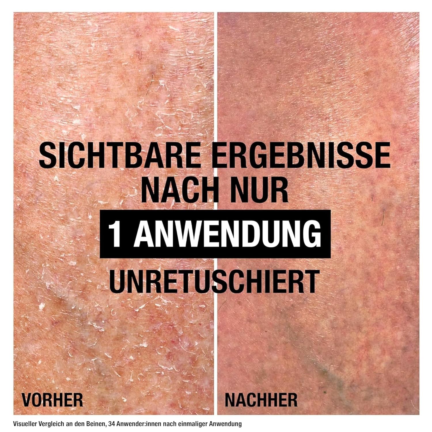 Thumbnail 2 de Neutrogena Intense Repair Reparierender CICA Bodybalsam mit Glycerin & Centella Asiatica – nicht fettende Körperlotion für sehr trockene Haut (250 ml)