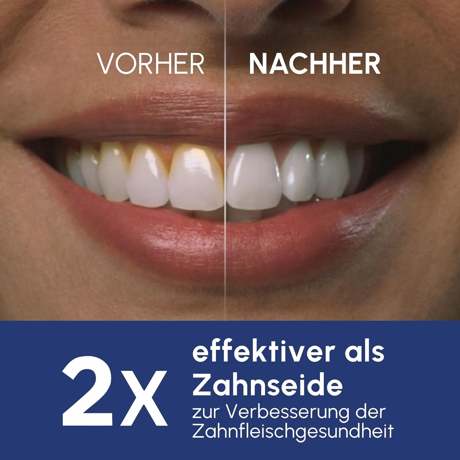Detalle de Waterpik Ultra Professional Munddusche — 6 Aufsätze