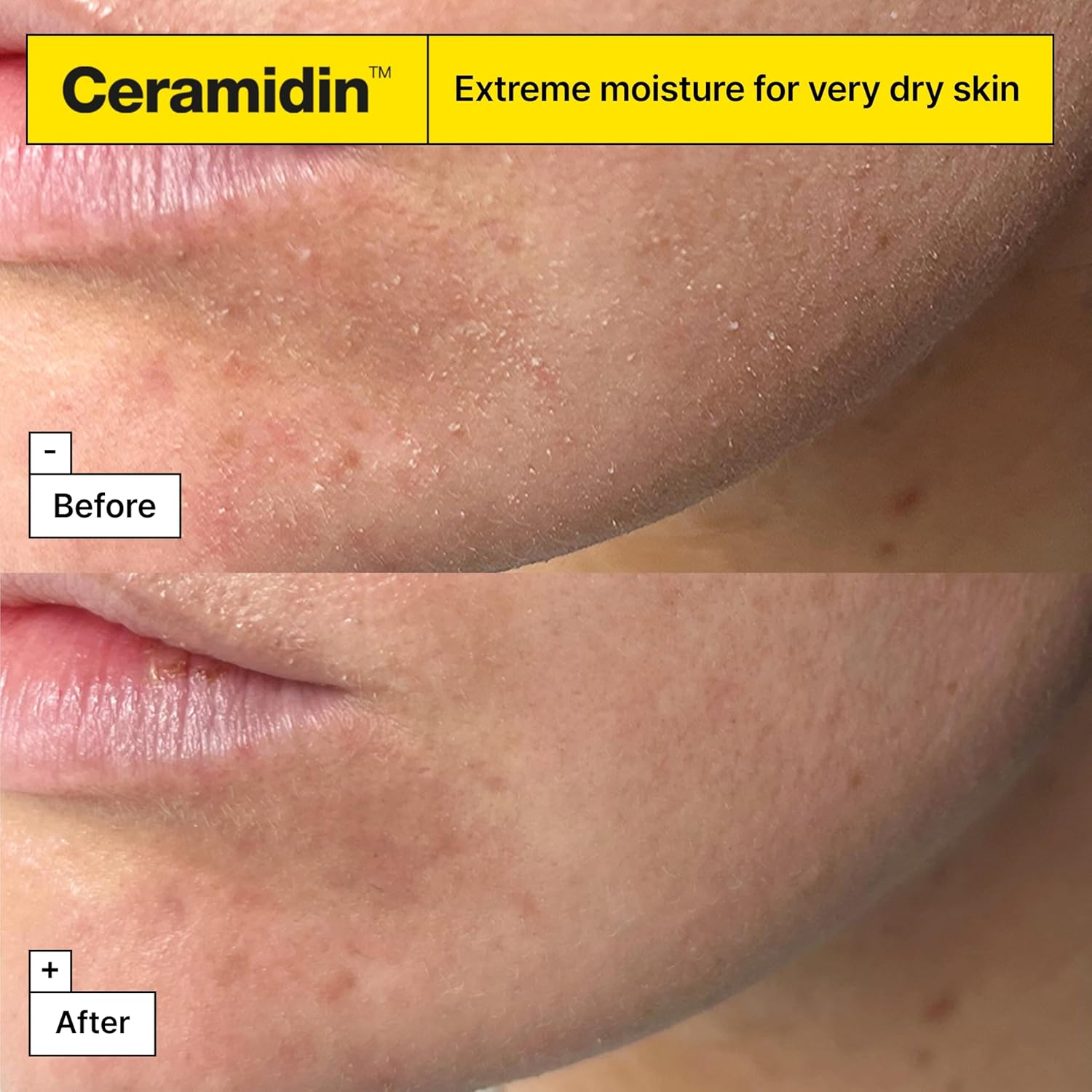 Thumbnail 3 de Dr.Jart+ Ceramidin Ectoin-Infused Face Cream: A practical pick for dry skin
