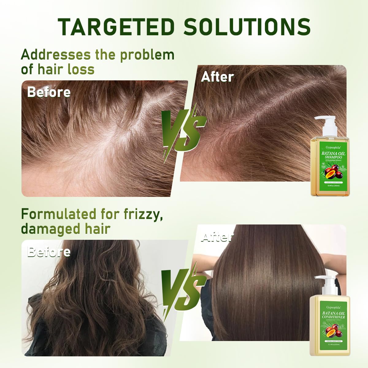 Detalle de Gypsophila Batana Oil Shampoo and Conditioner (Sulfate-Free) for Hair Growth, Hair Loss Support, and Frizz Control
